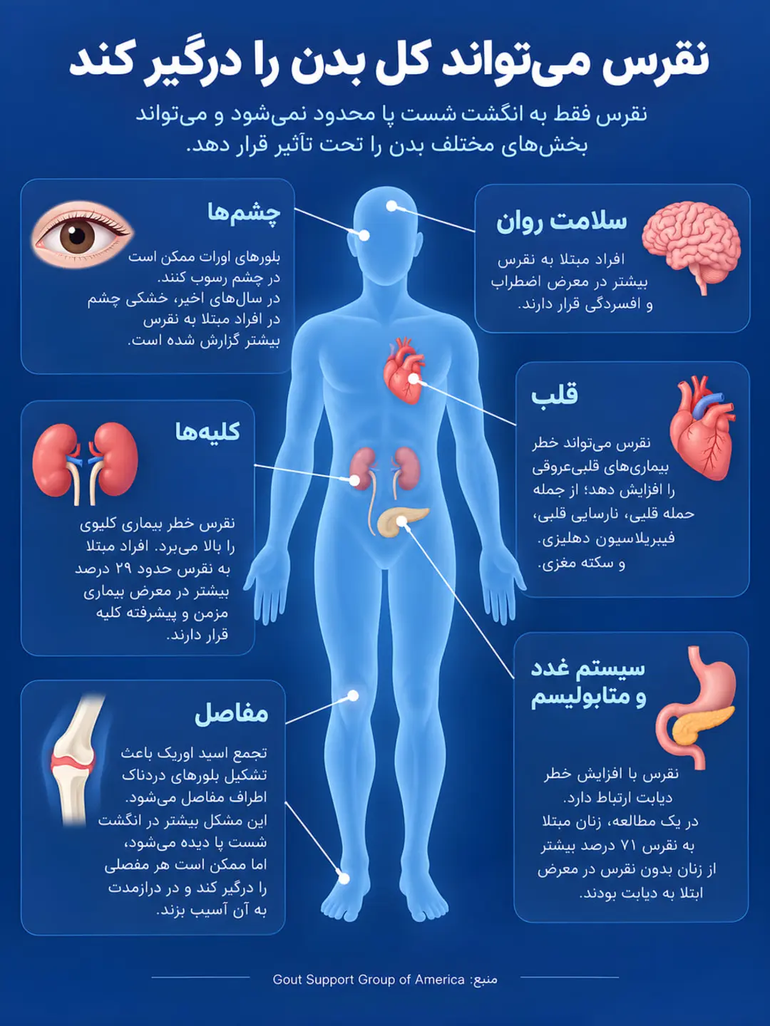 نمای آناتومیک بدن انسان و تاثیرات بیماری نقرس بر چشم، قلب، کلیه، مغز و مفاصل
