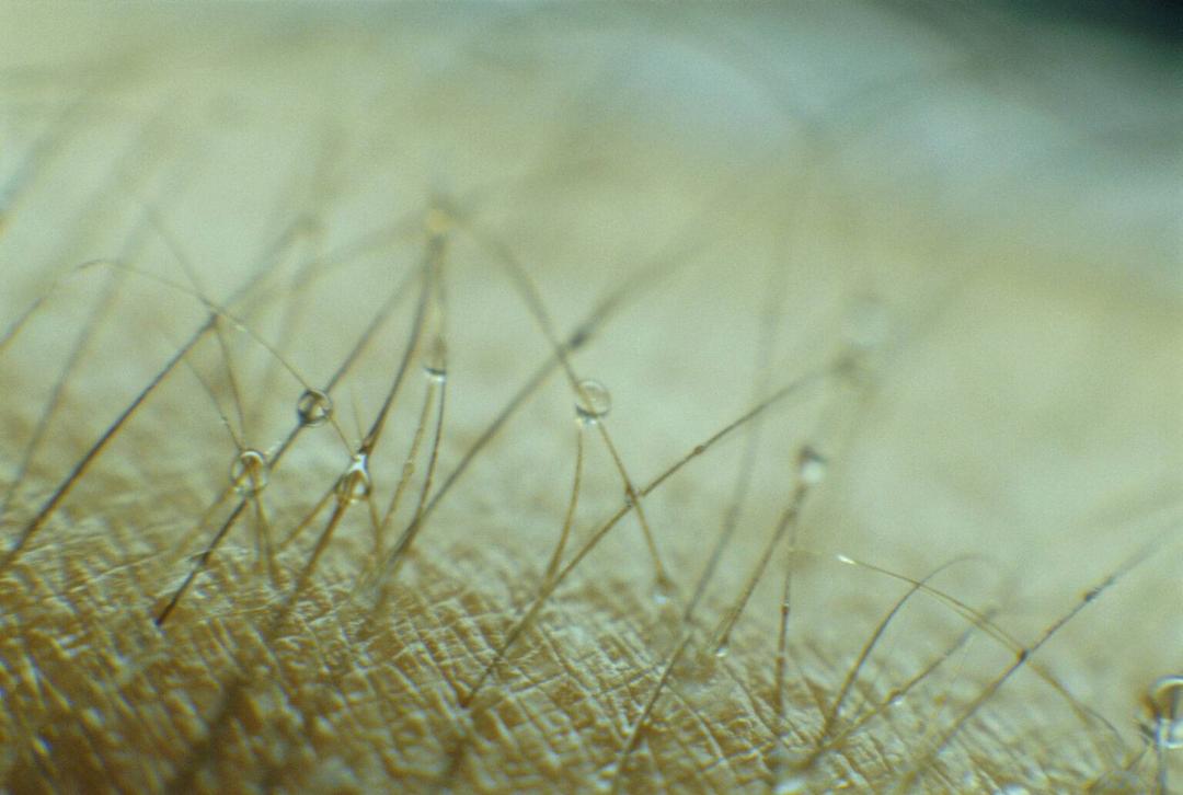 عرق و موهای میکروسکوپی