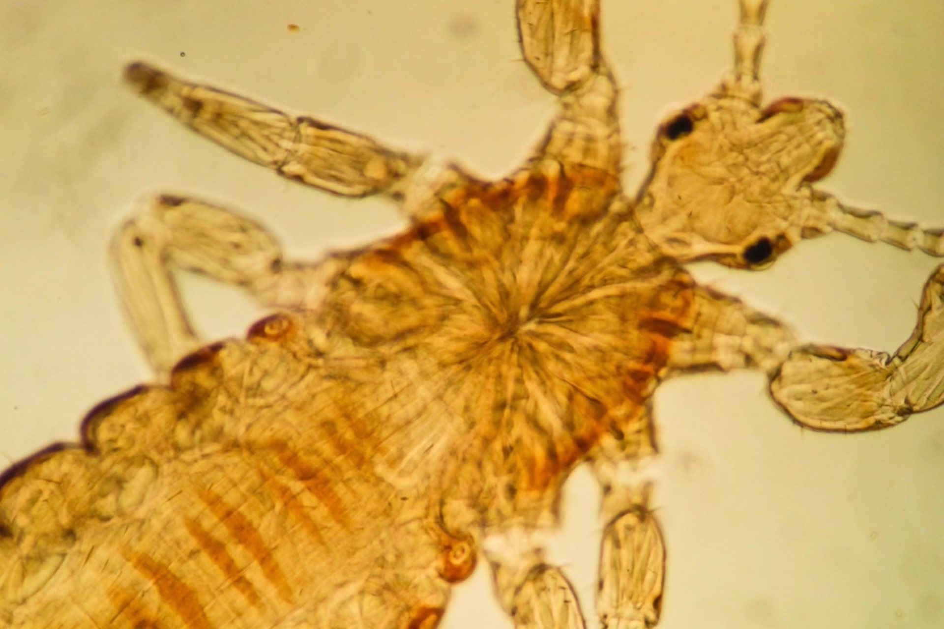 شپش سر زیر میکروسکوپ