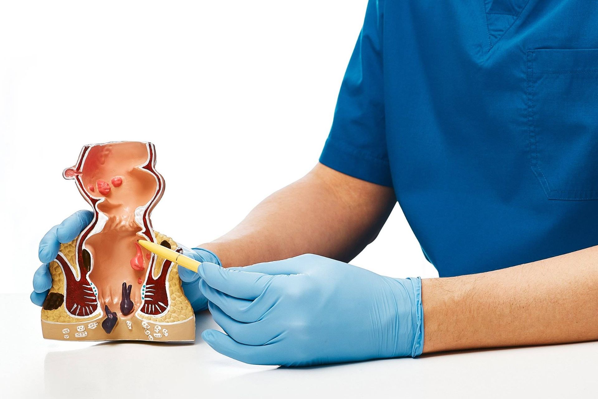 مدل هموروئید