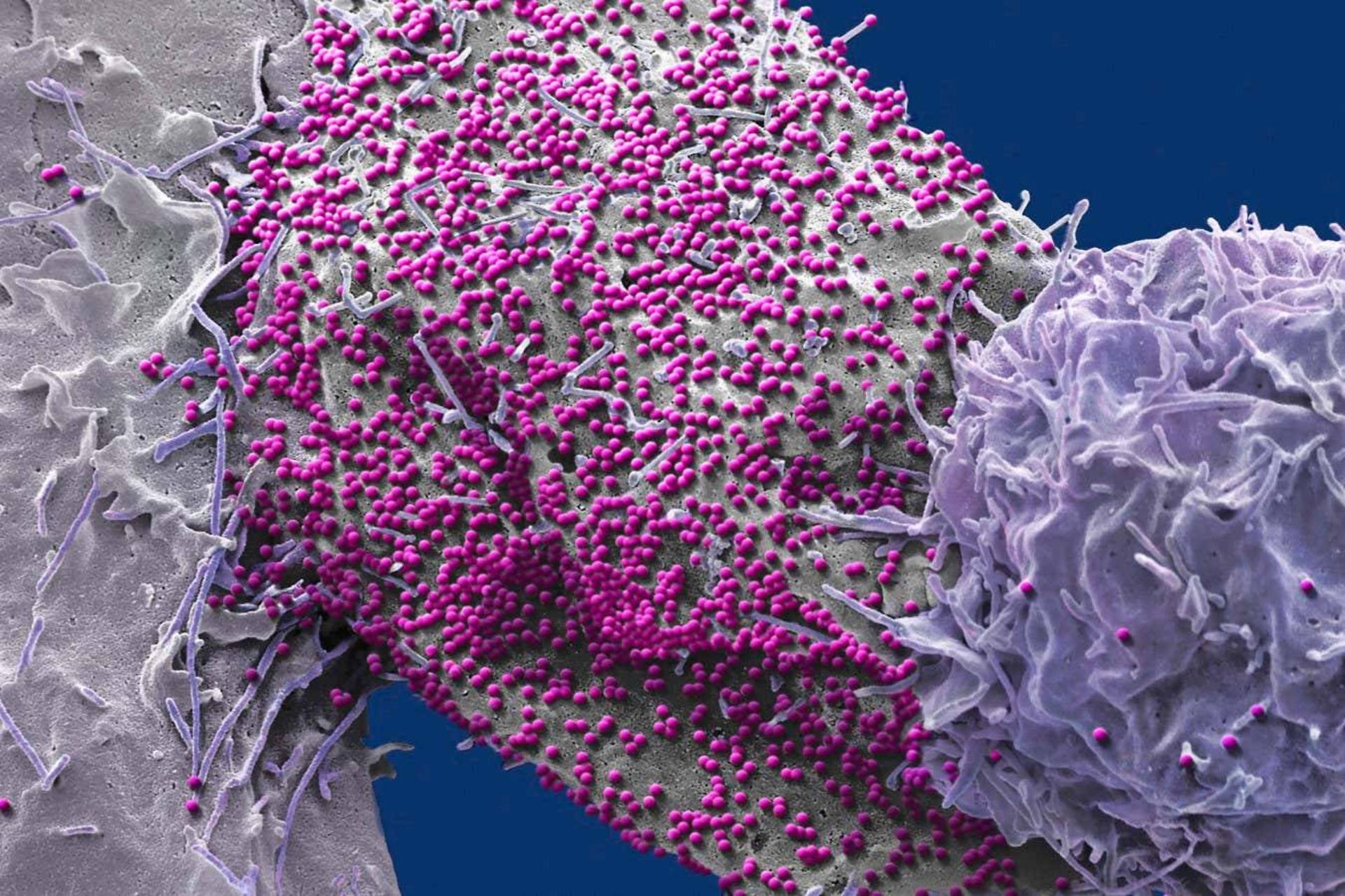 یک سلول انسانی آلوده به HIV