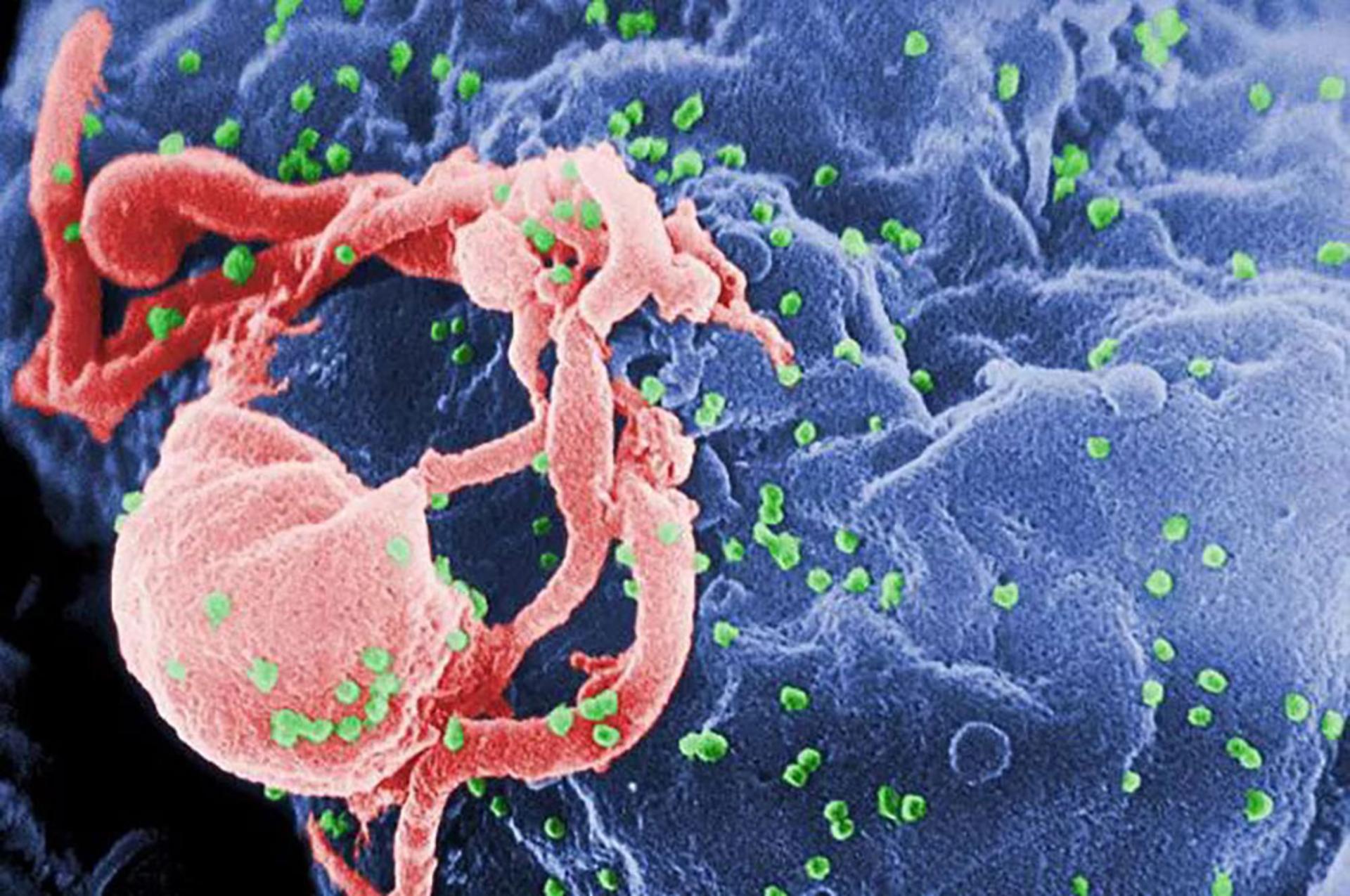 ویروس HIV