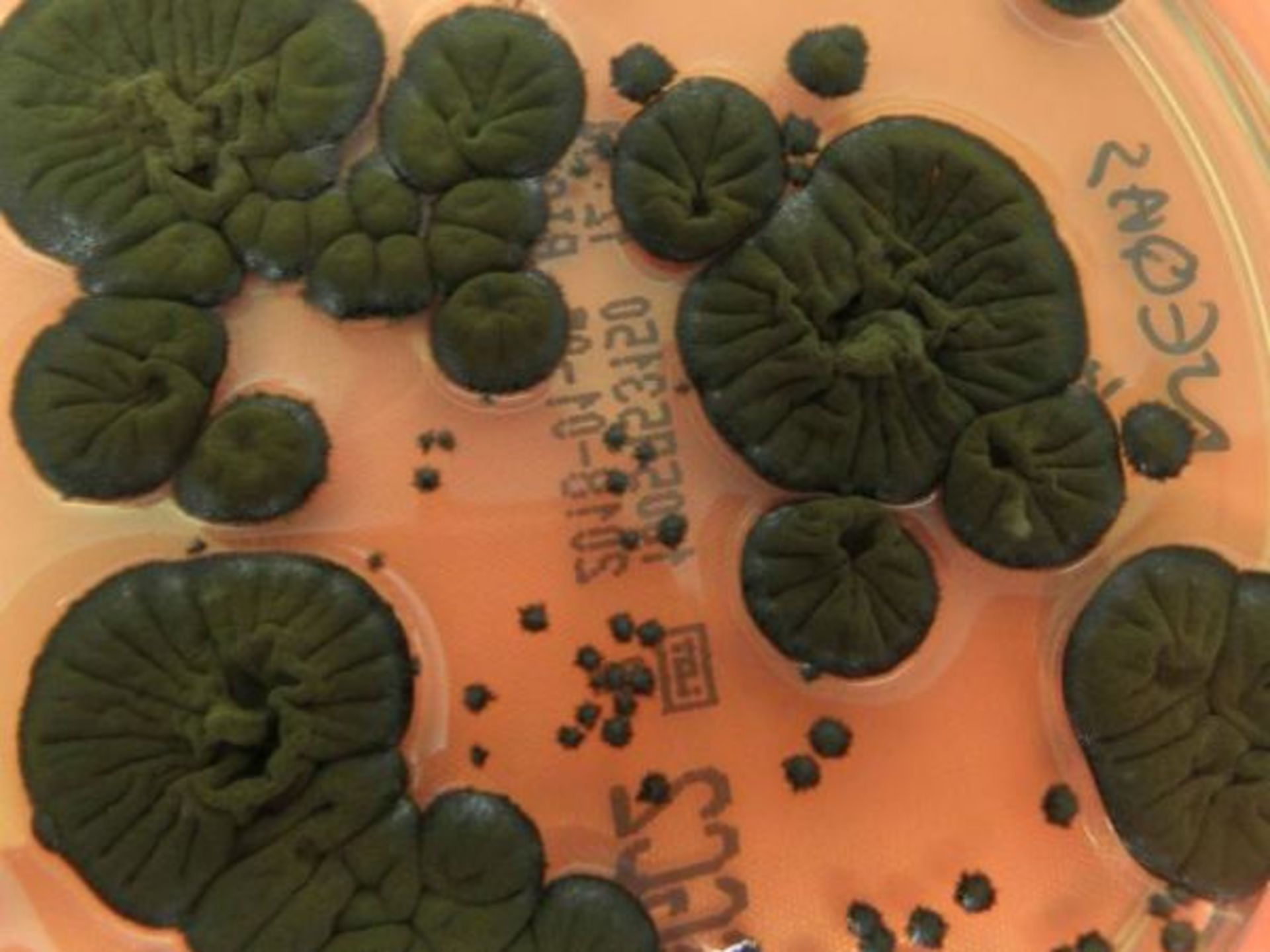 قارچ سیاه کلادوسپوریوم اسفروسپرموم