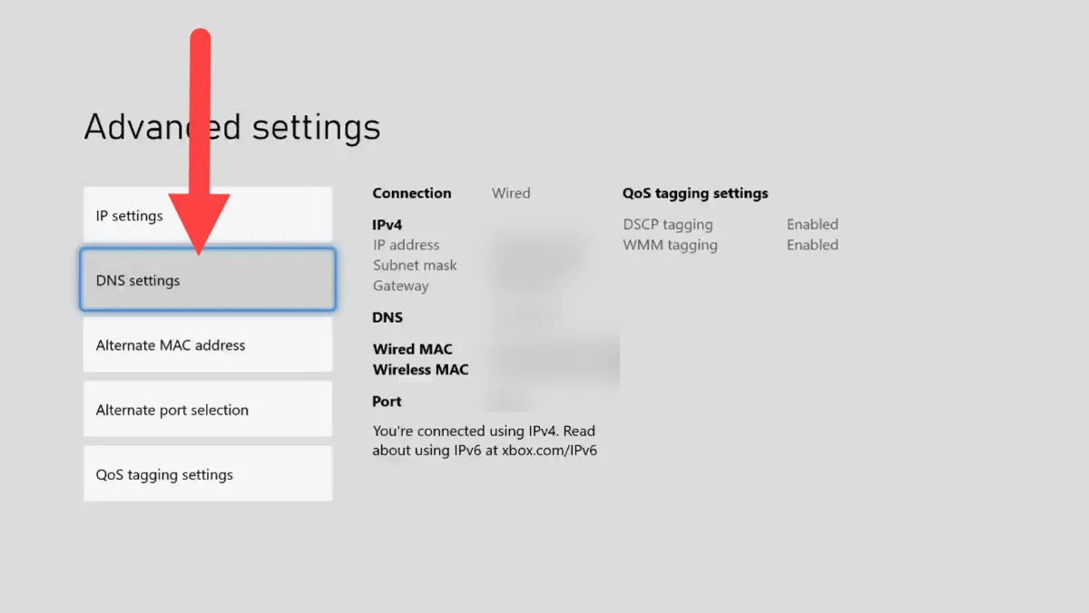 Xbox DNS settings