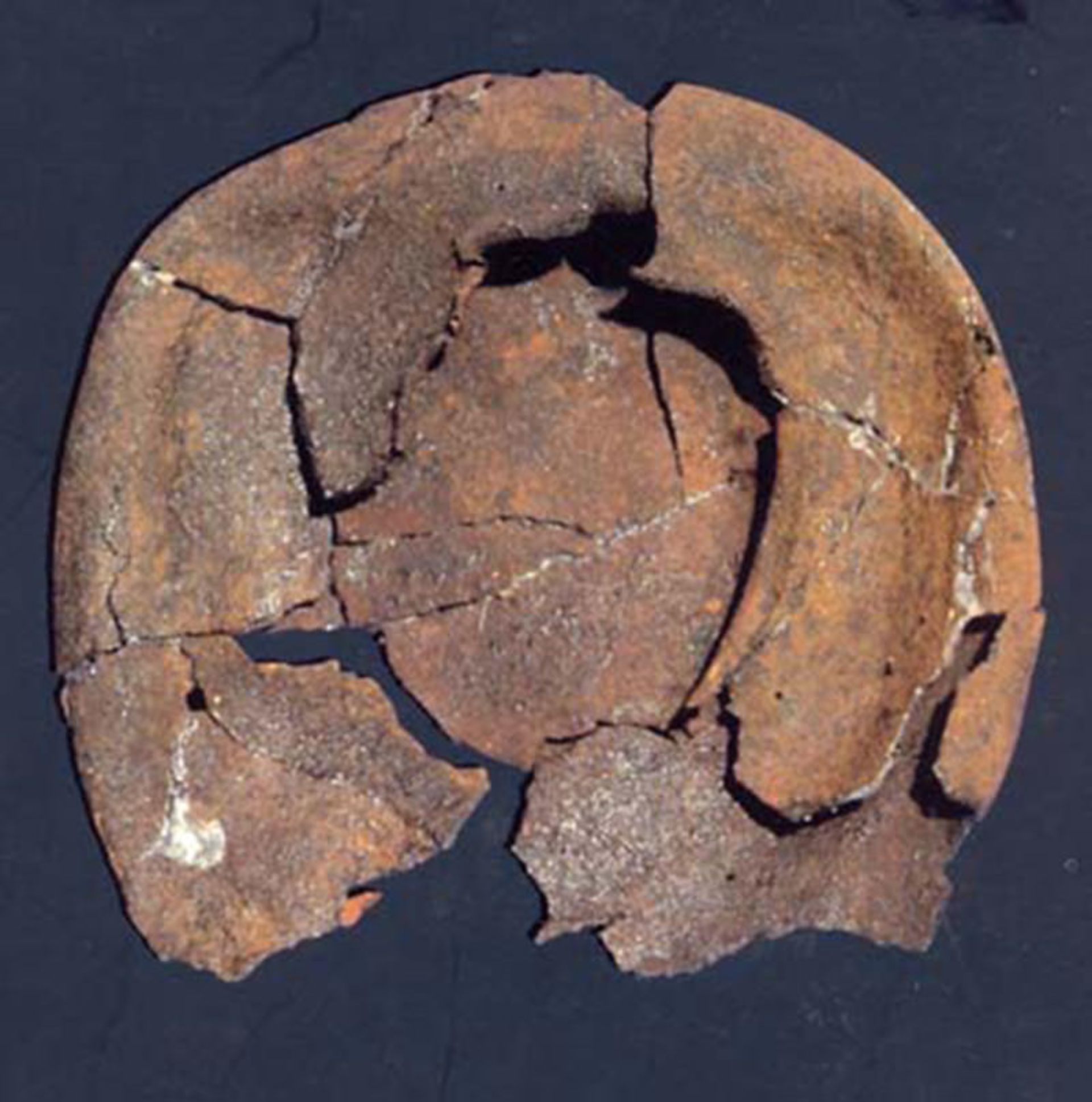 کیسه چرمی چشم مصنوعی-شهرسوخته