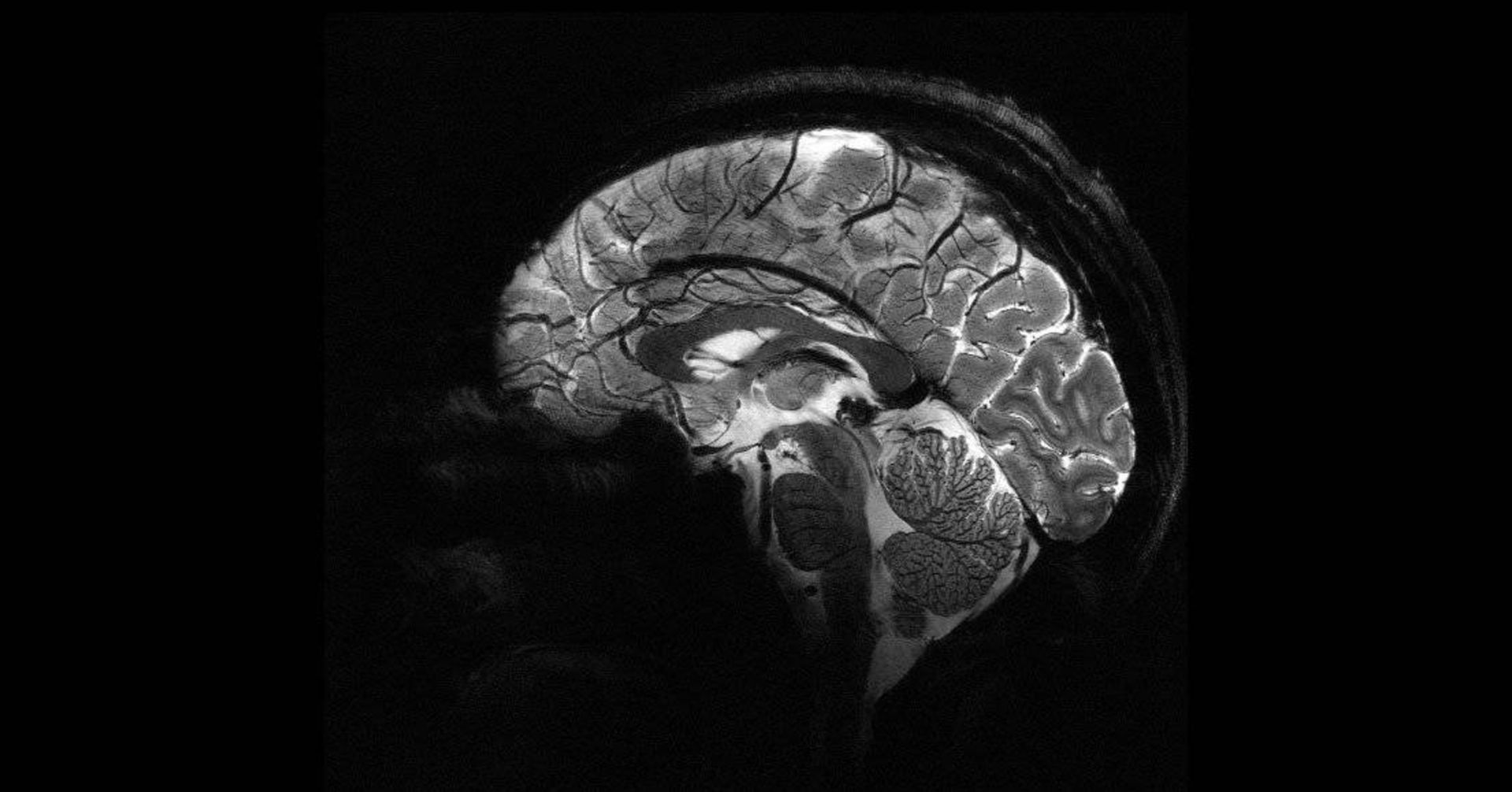 اسکن مغز انسان