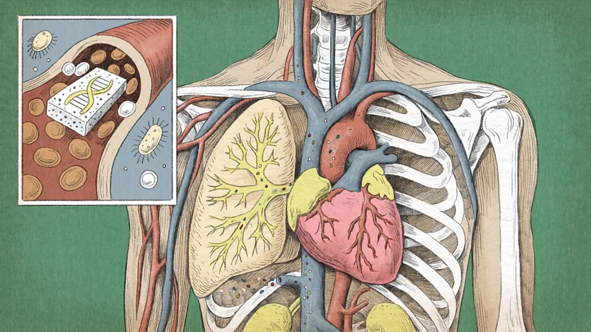 تصویر شریان کاروتید