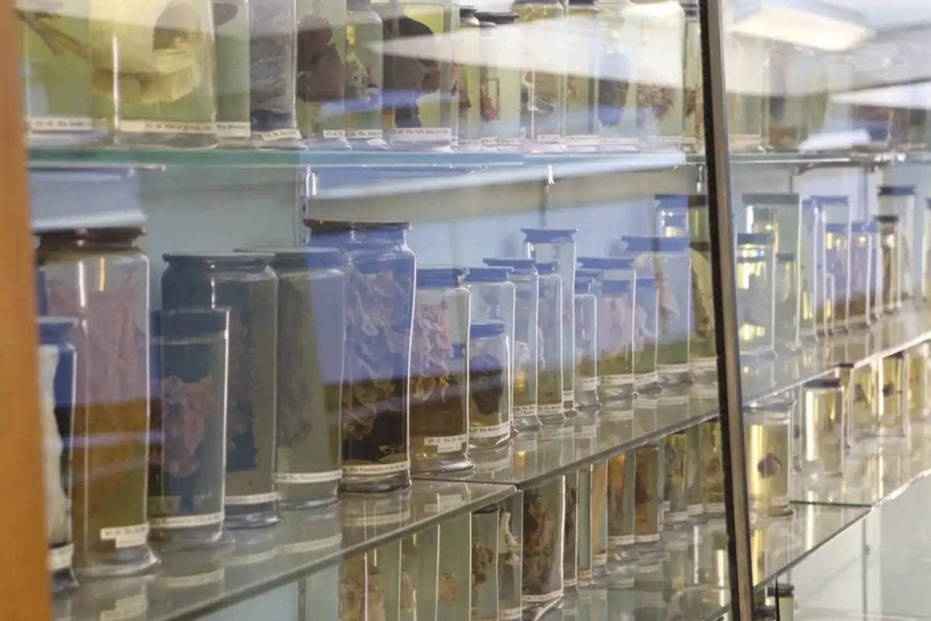 نمونه های پزشکی در موزه آناتومی هانترین 