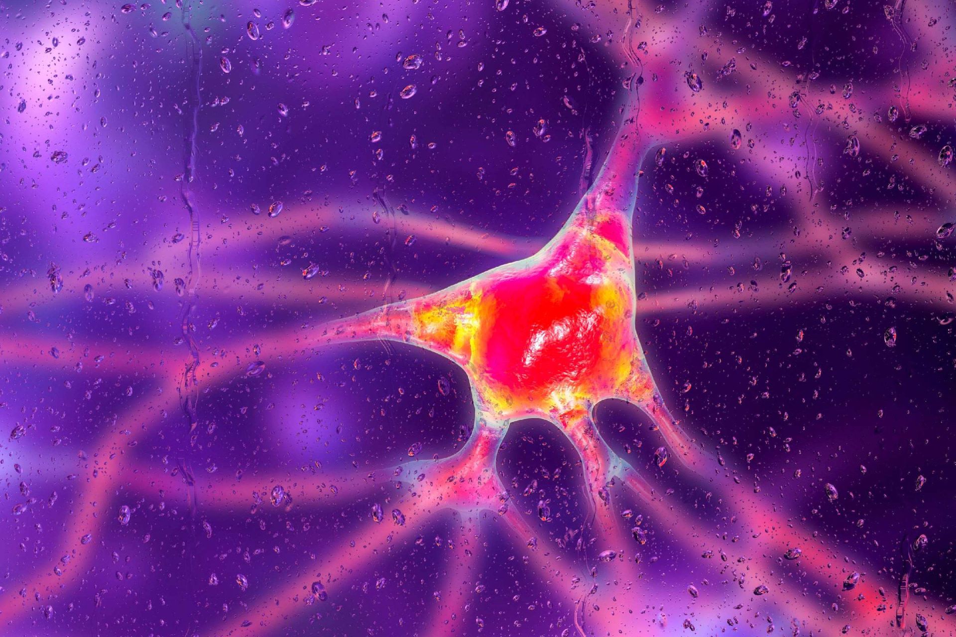 تصویرسازی بیماری هانتینگتون