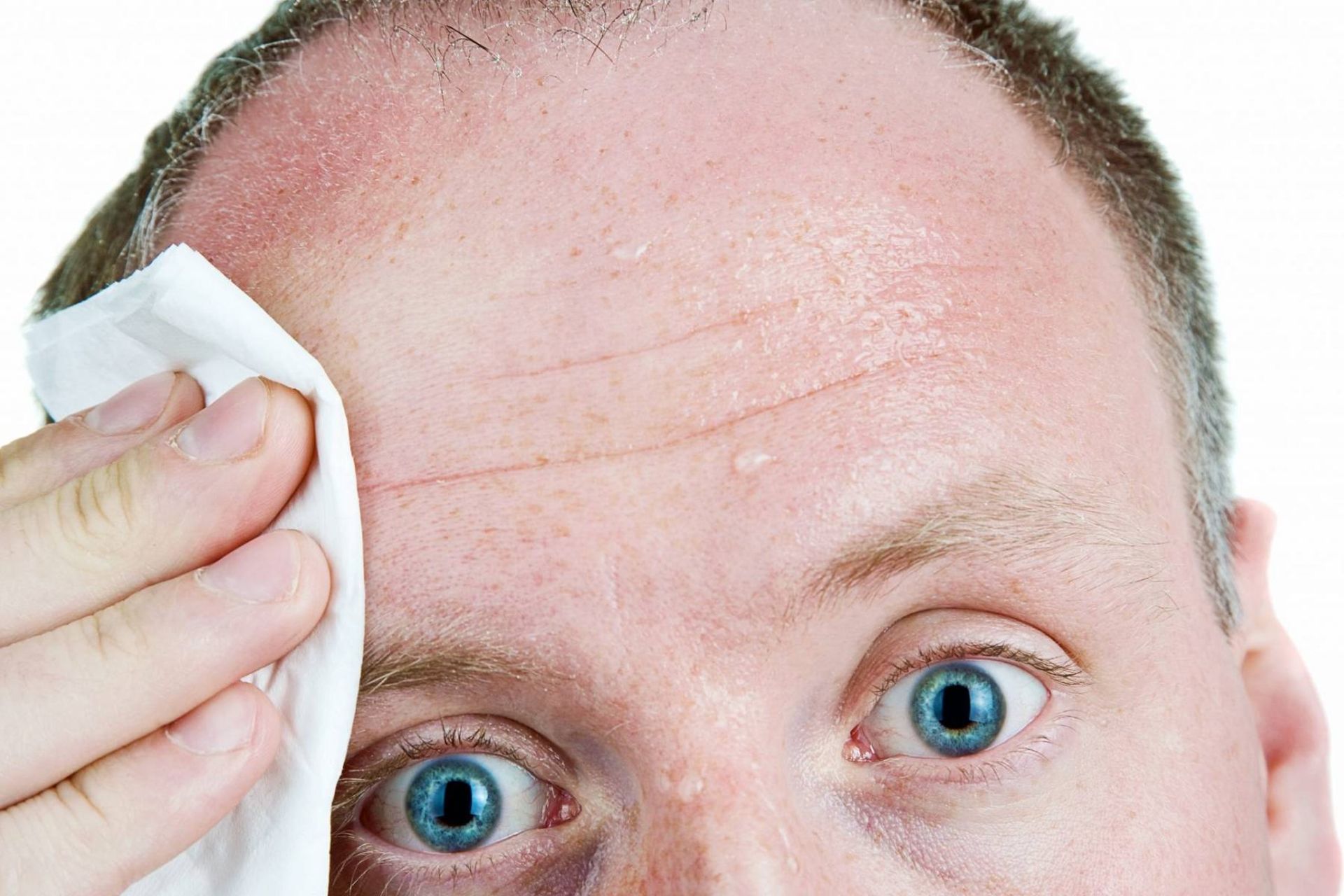 عرق کردن صورت