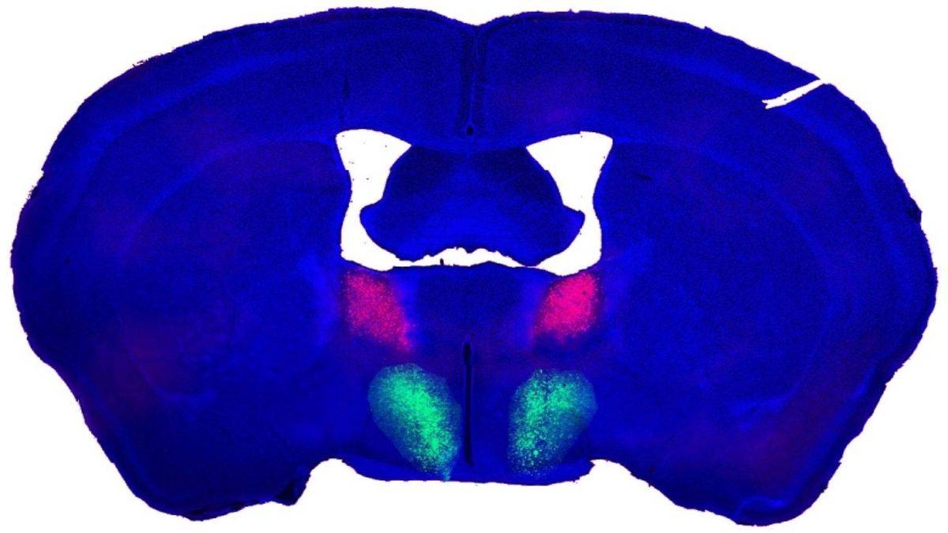 اتصال ارگانوئید به مغز موش