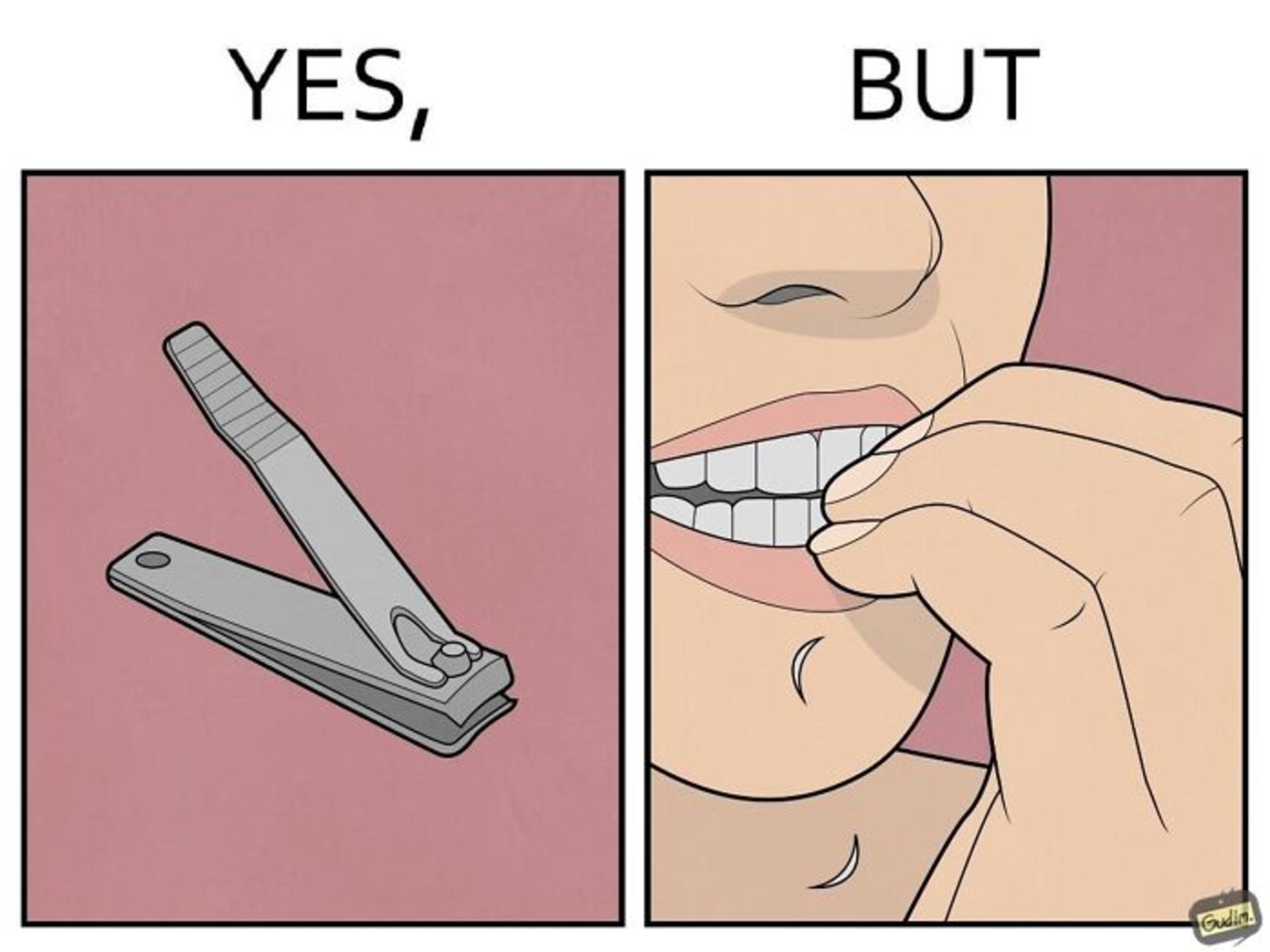 تصویرسازی‌ Yes, But جویدن ناخن