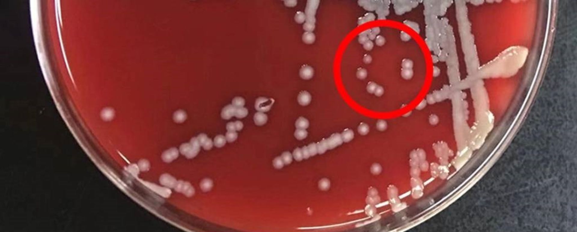 باکتری کلبسیلا آئروژنز