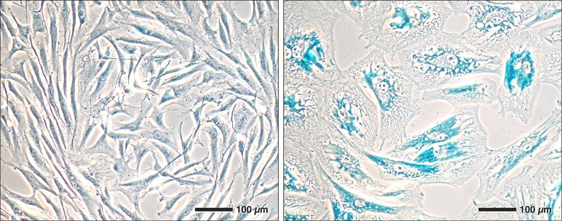 سلول‌های آزمایشگاهی با افزایش سن کشیده‌تر شده‌اند