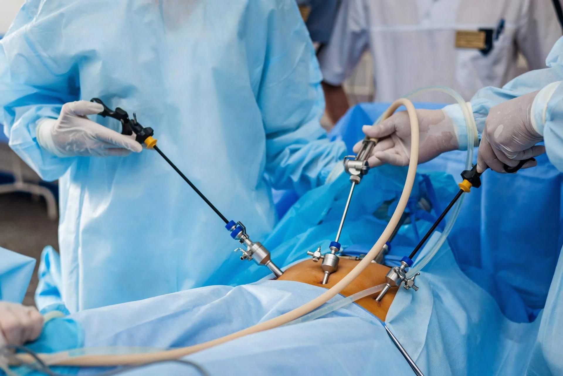 لاپاراسکوپی چیست و چگونه انجام می‌شود؟