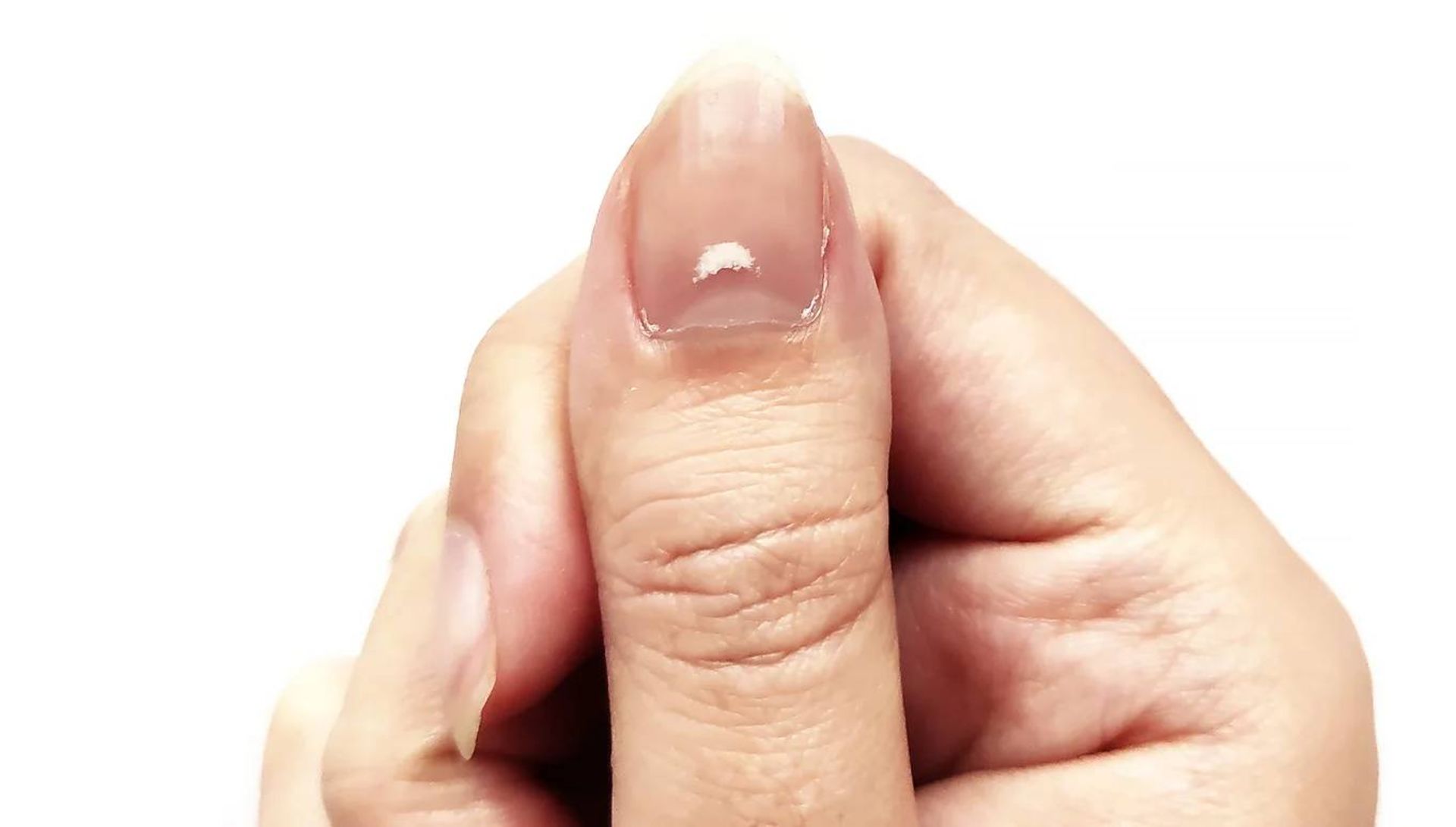 لکه سفید روی ناخن