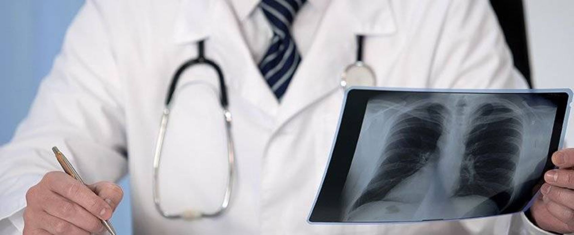 رادیولوژی قفسه سینه