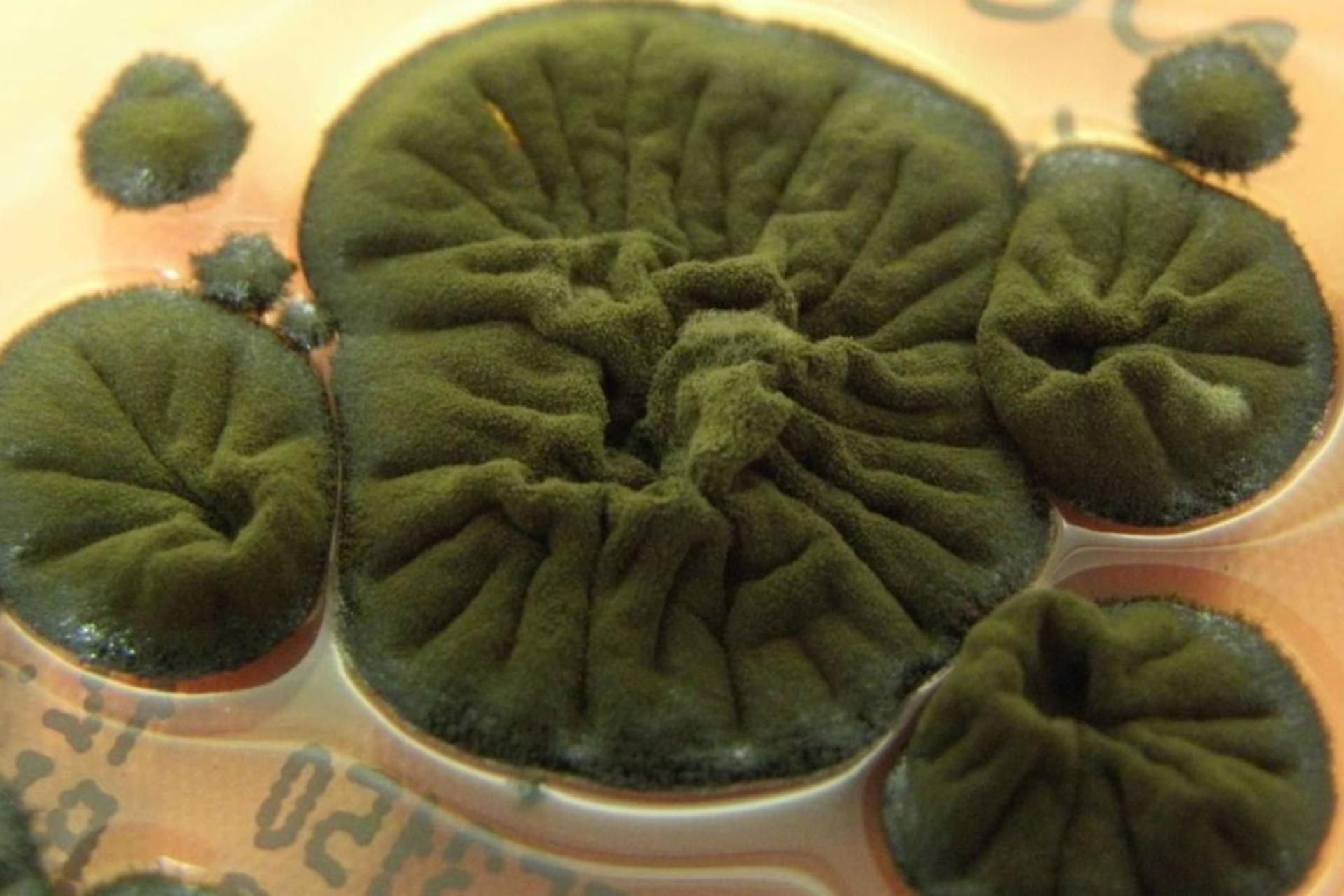 قارچ سیاه کلادوسپوریوم اسفروسپرموم، کشت شده در مرکز بیمارستان دانشگاه کویمبرا در پرتغال