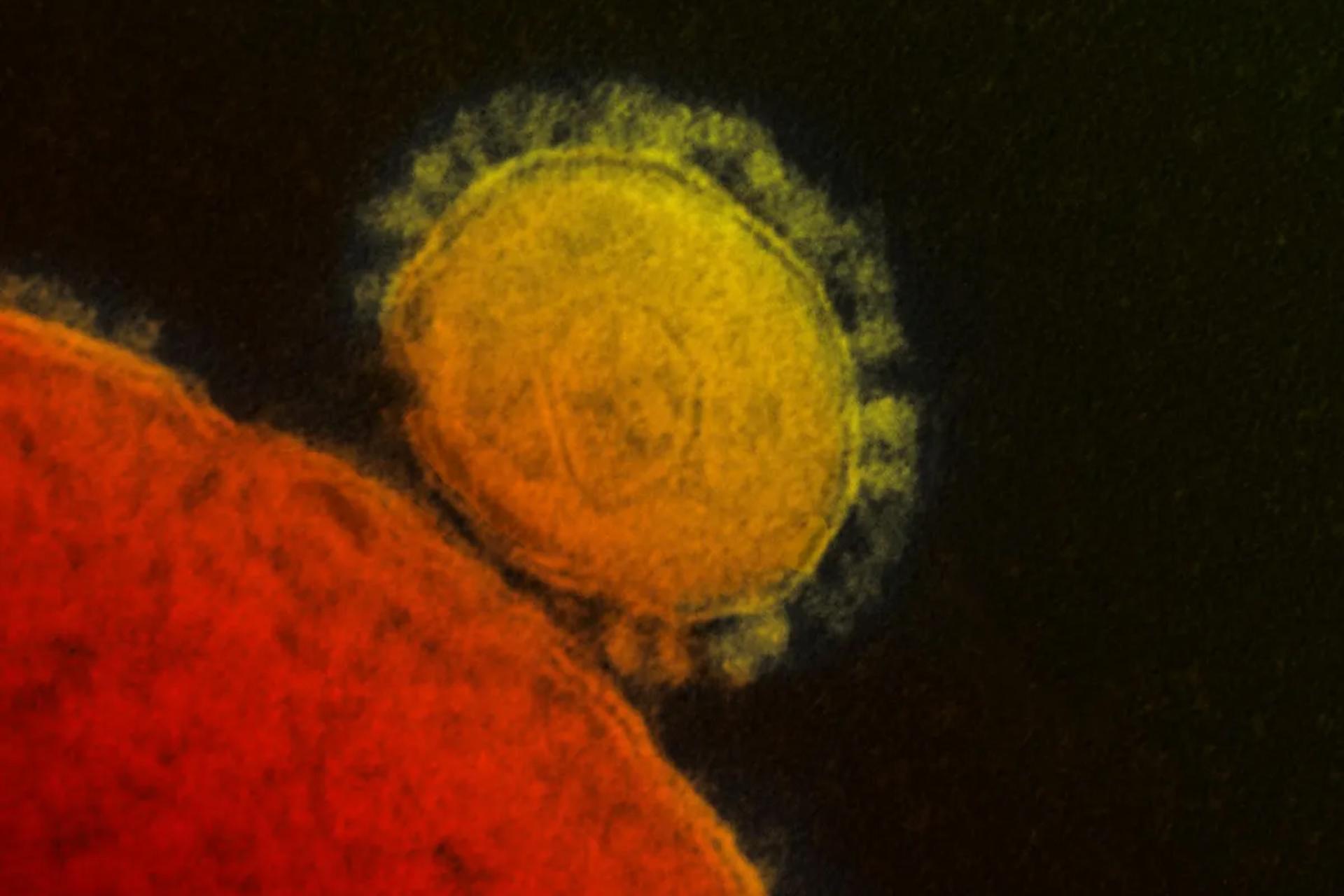 ویروس مرس شبیه به کروناویروس (mers-cov)