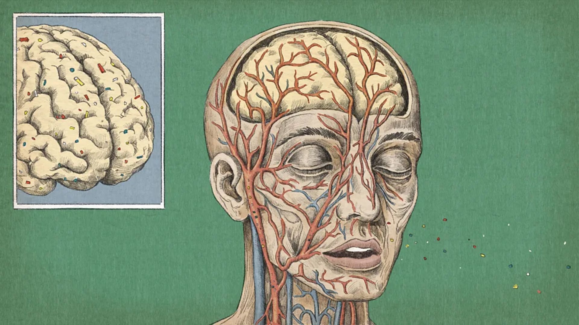 میکروپلاستیک‌ها در مغز انسان