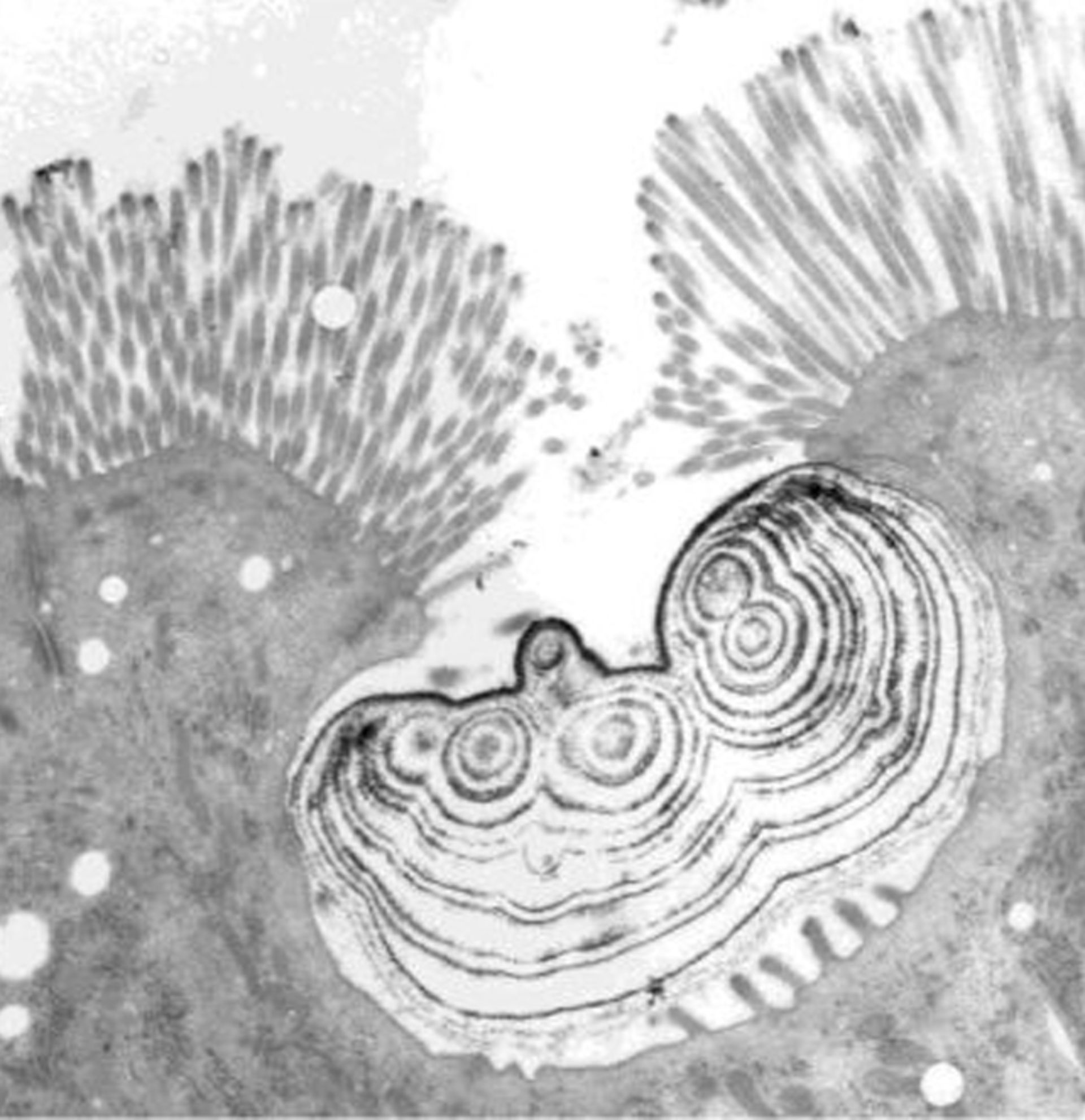 تصویر میکروسکوپ الکترونی عبوری از ذره‌ای که در یک حفره‌ی رأسی یافت شده است