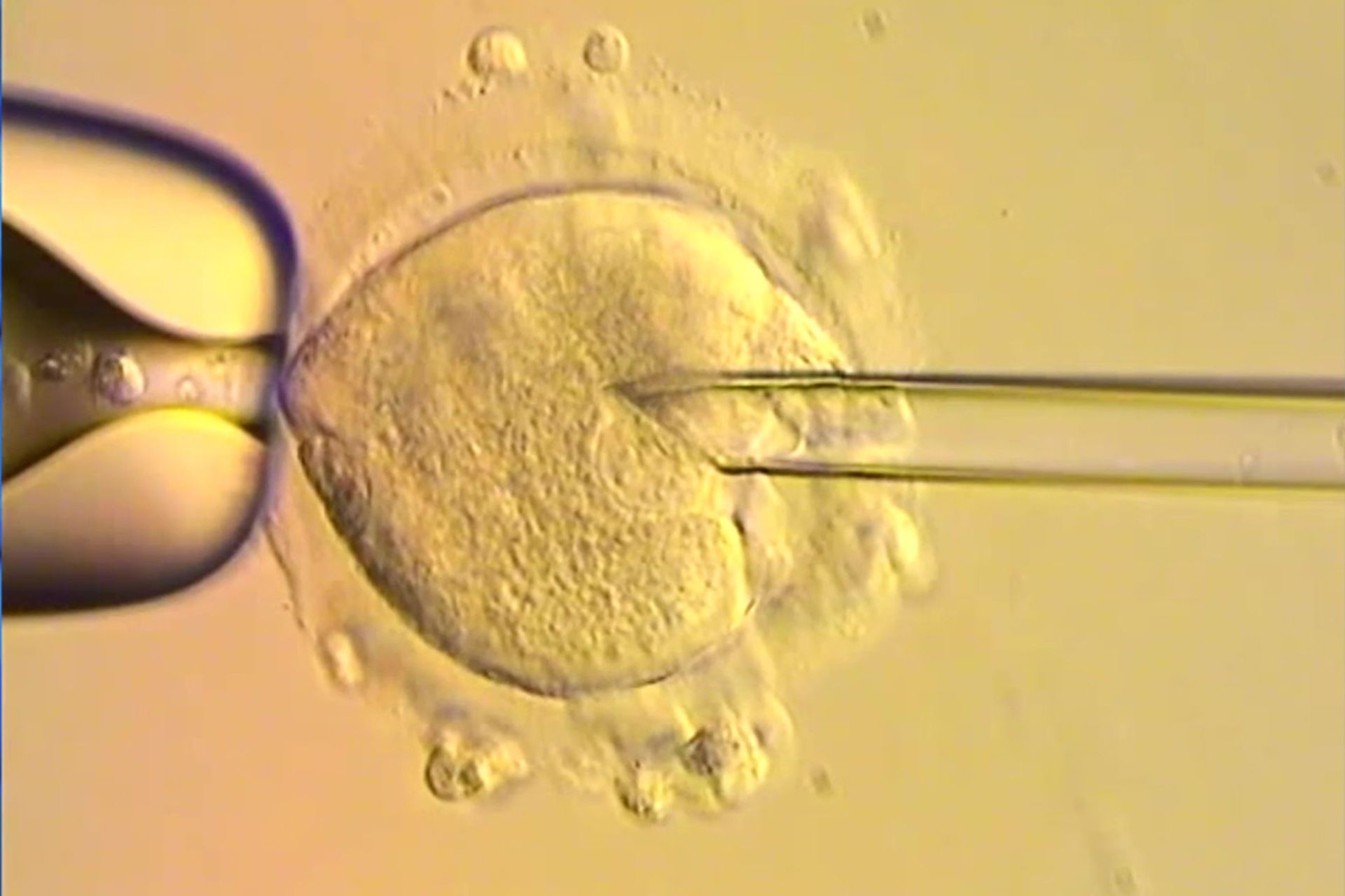 درمان با اهدای میتوکندری