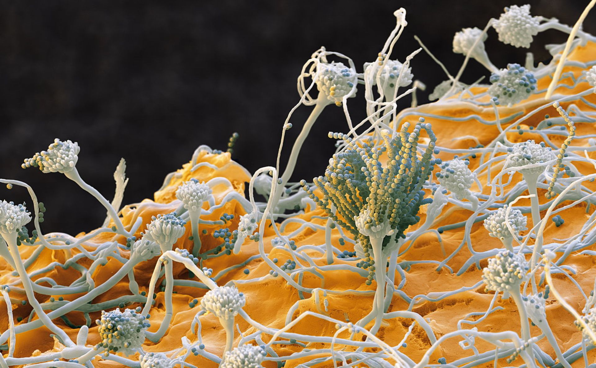 تصویر میکروسکوپی سطح کپک Emericella nidulaus با هاگ‌های کروی