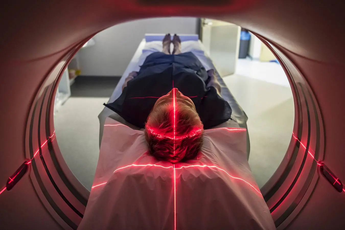 اسکن MRI