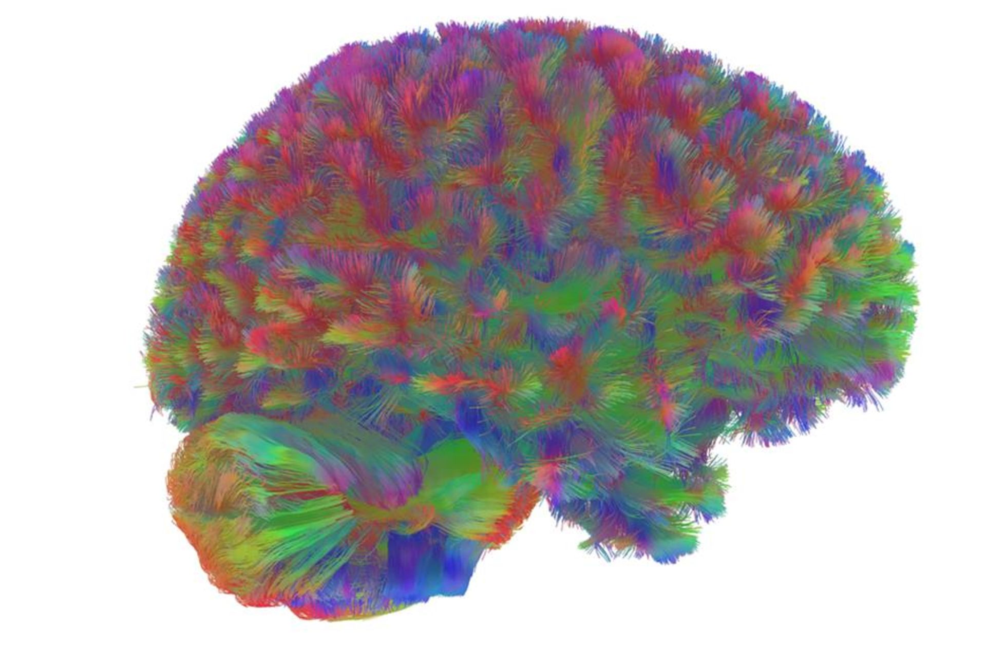 تراکتوگرافی MRI مغز انسان