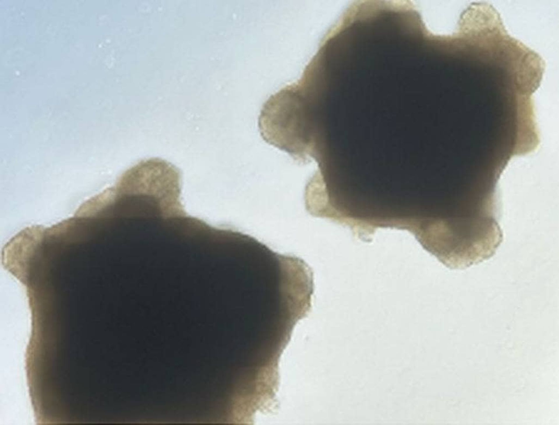 ارگانوئیدهای مغزی