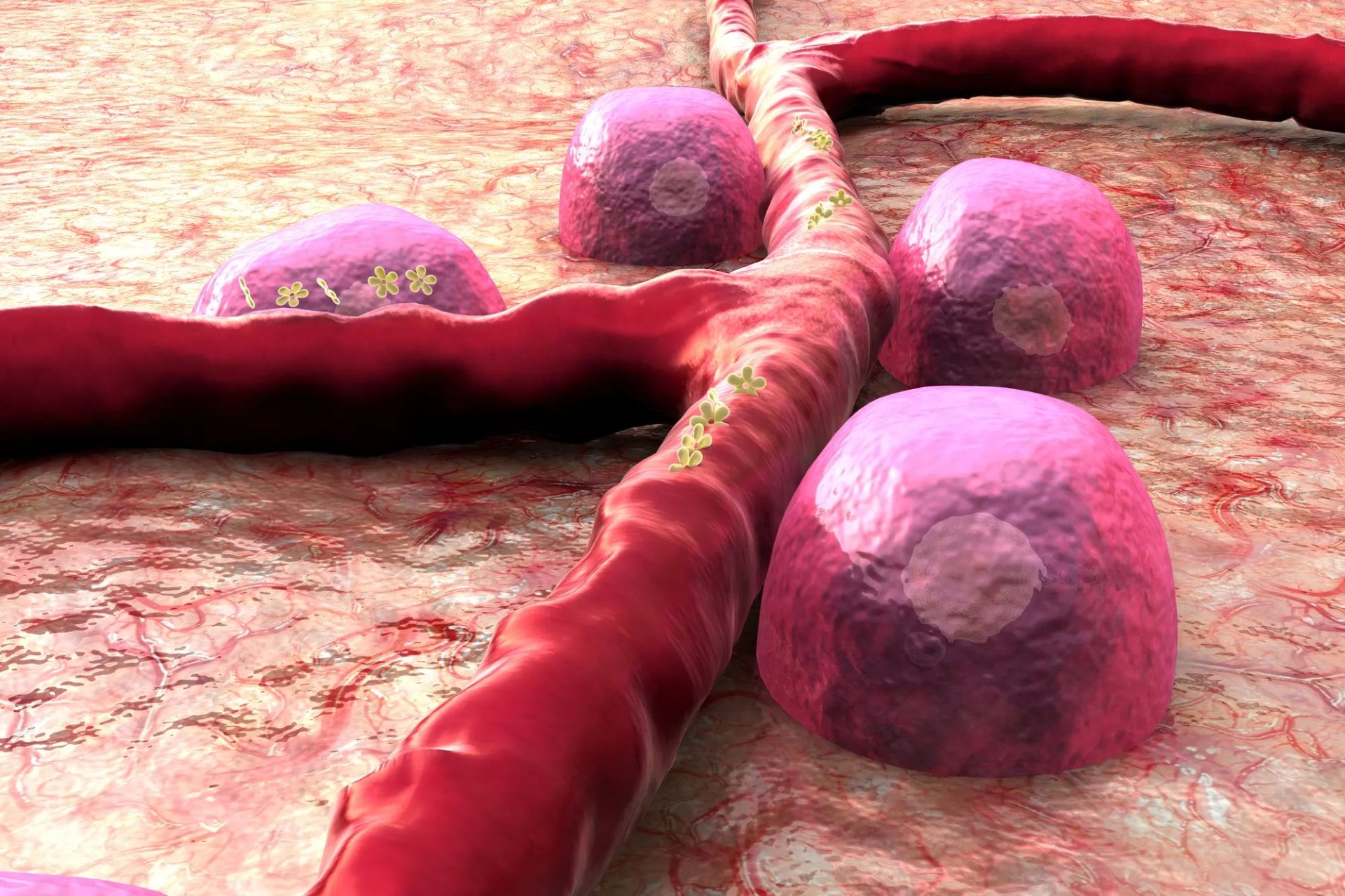 سلول های پانکراس آسیب دیده توسط دیابت