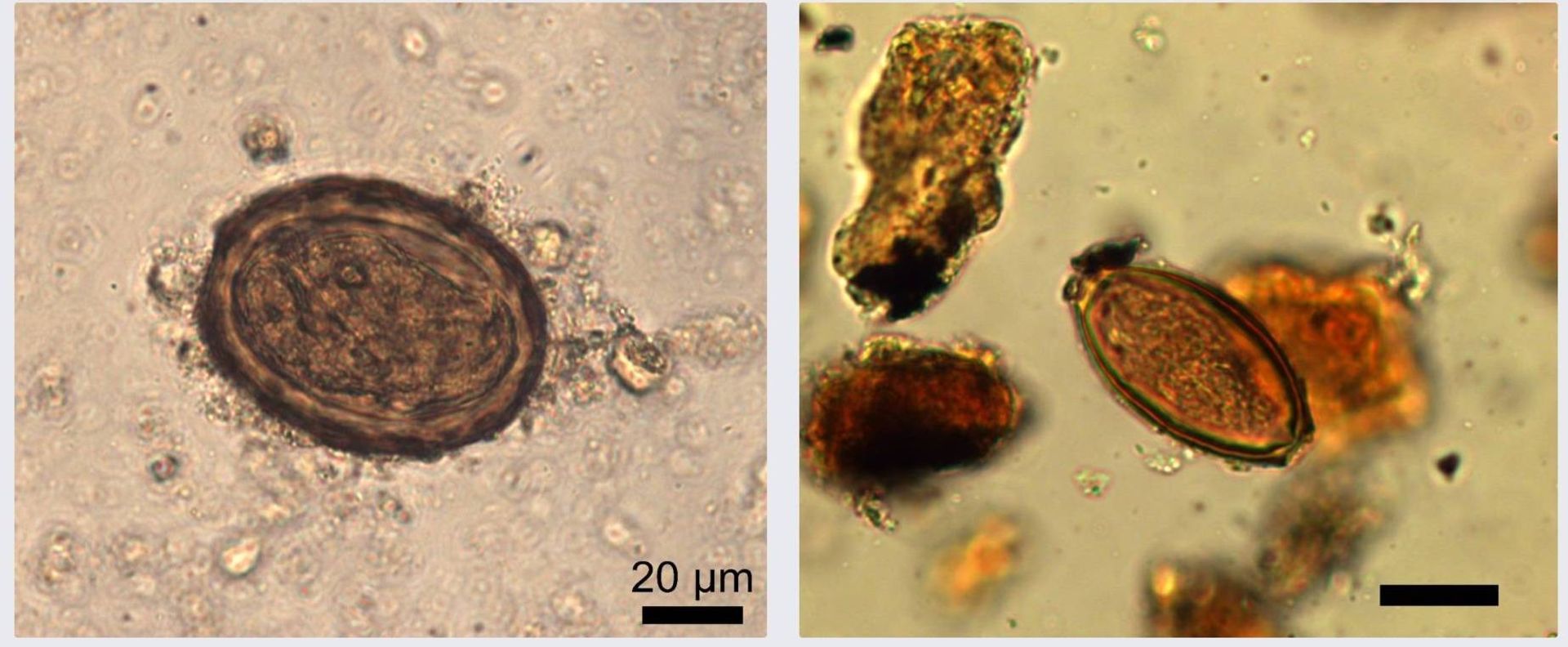 تخم کرم های رسوبات فاضلاب دژ روم باستان