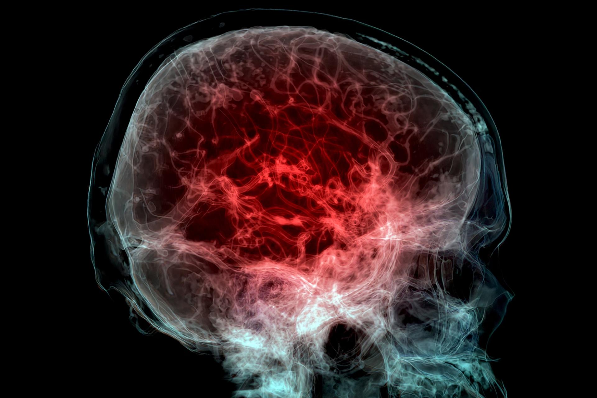 کشف شواهد تازه از نقش میکروپلاستیک‌ها در بروز اختلالات روانی