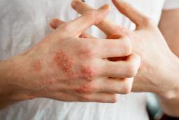 سلامت روده چگونه بر پوست اثر می‌گذارد؟