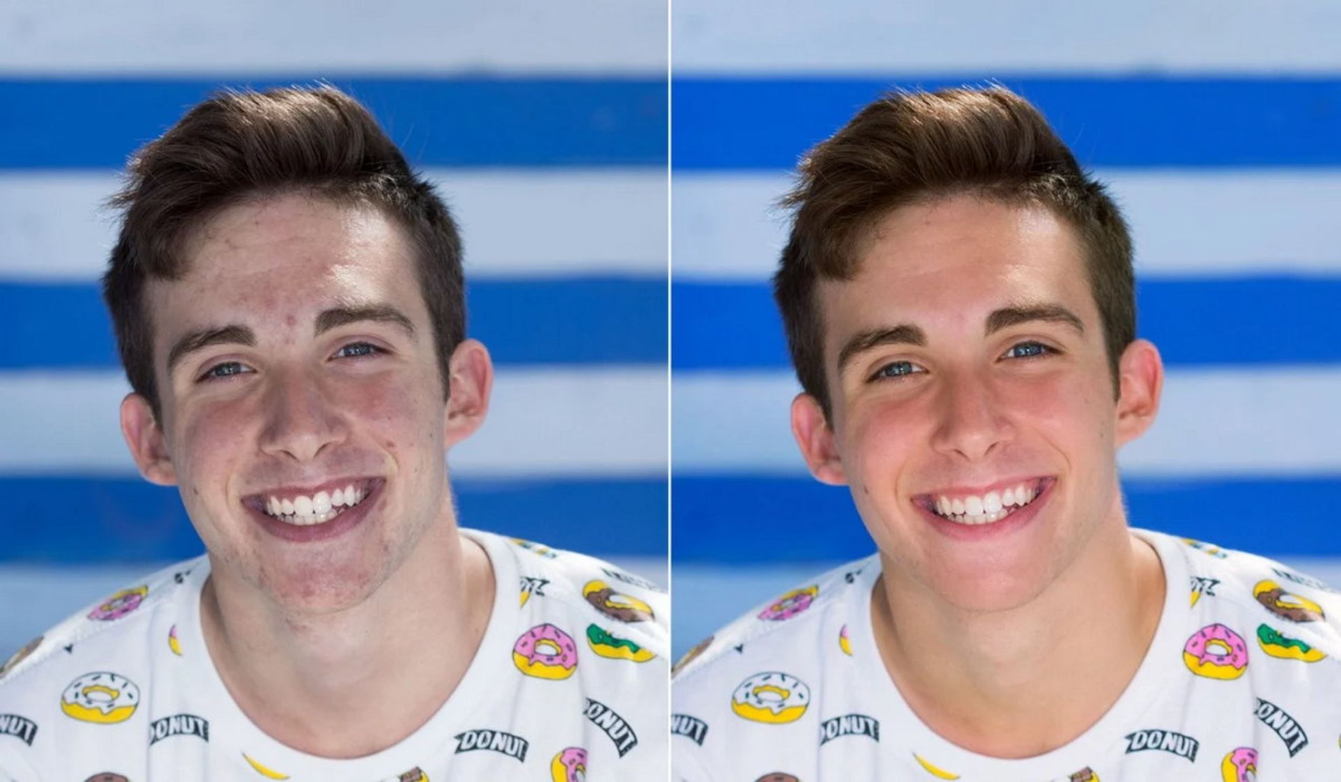 یک پسر در دو عکس متفاوت، یکی با فیلتر و یکی بدون فیلتر