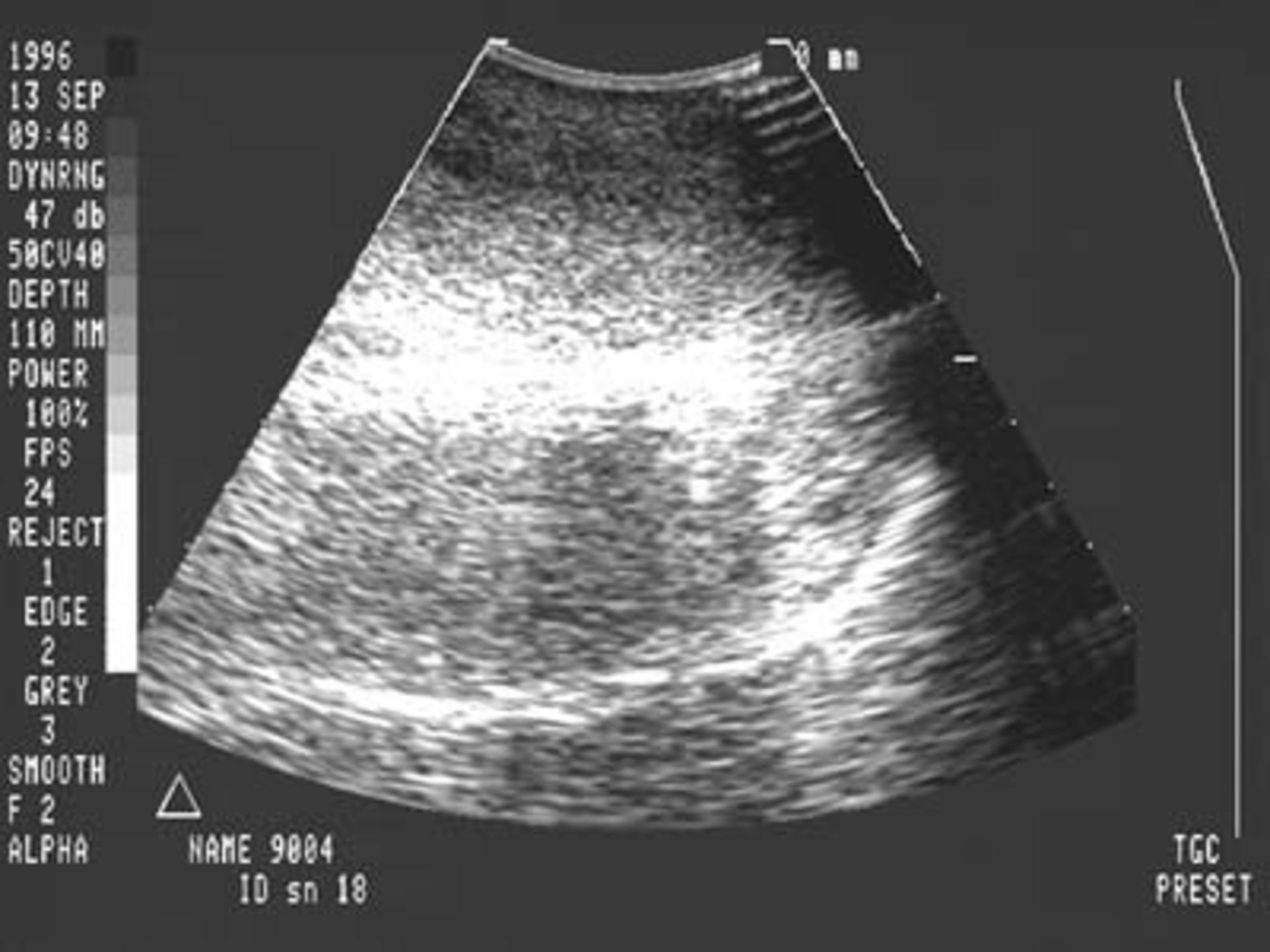 Spots inside the ultrasound image