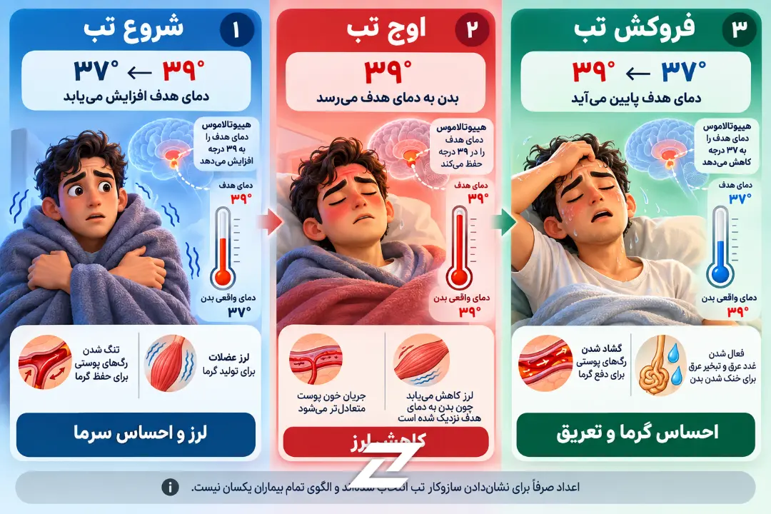 نمودار مراحل تب شامل شروع لرز، اوج دمای بدن و فروکش کردن تب