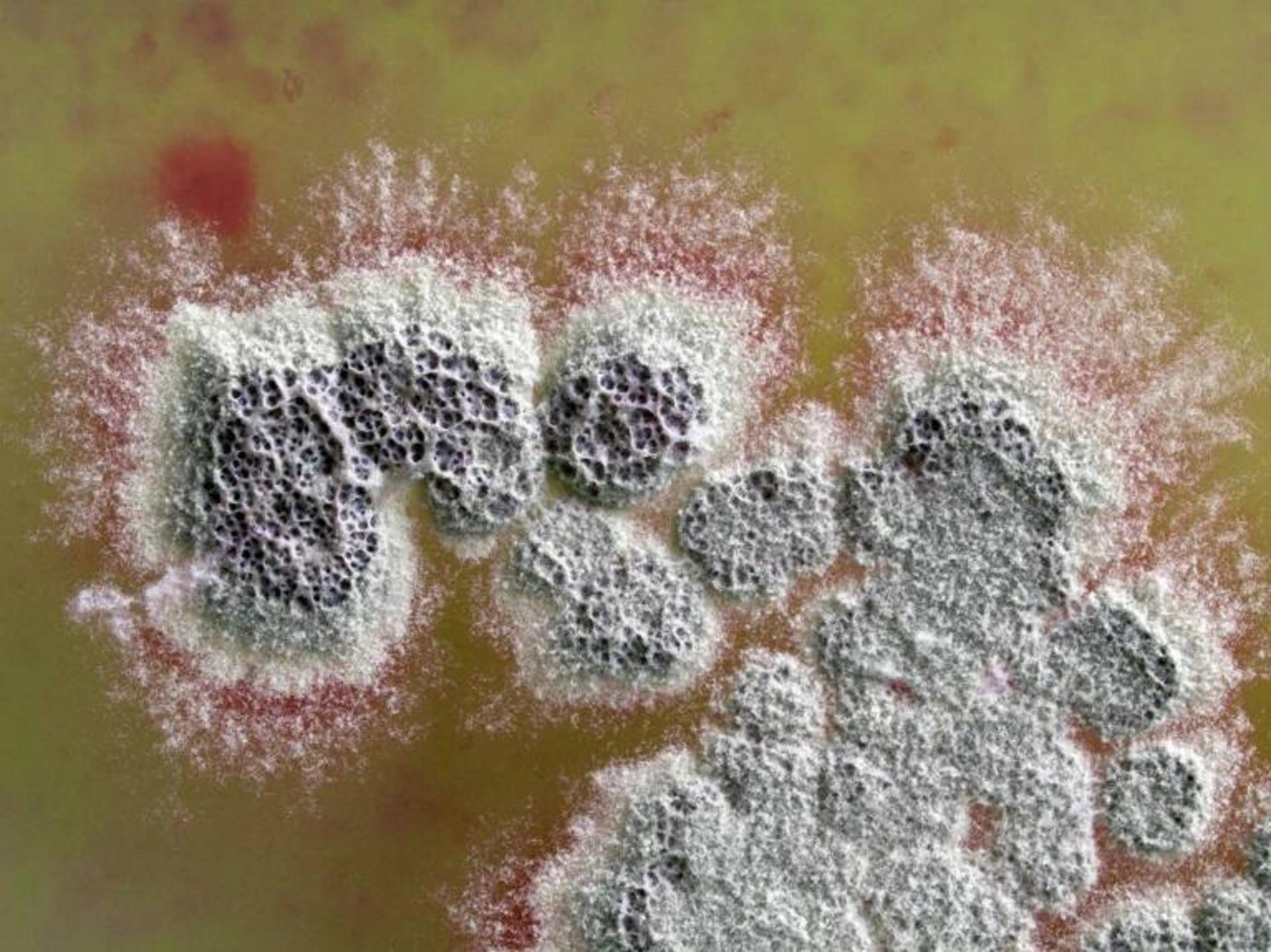 کلنی باکتری‌ Streptomyces coelicolor