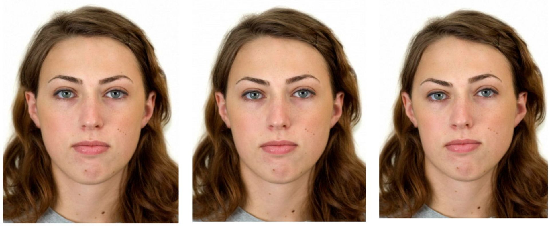 متقارن نبودن چهره یک زن در سه نما