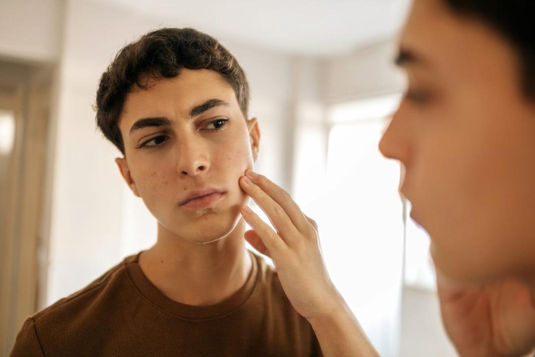 نوجوان در حال بررسی جوش‌ها و وضعیت پوست صورت در آینه