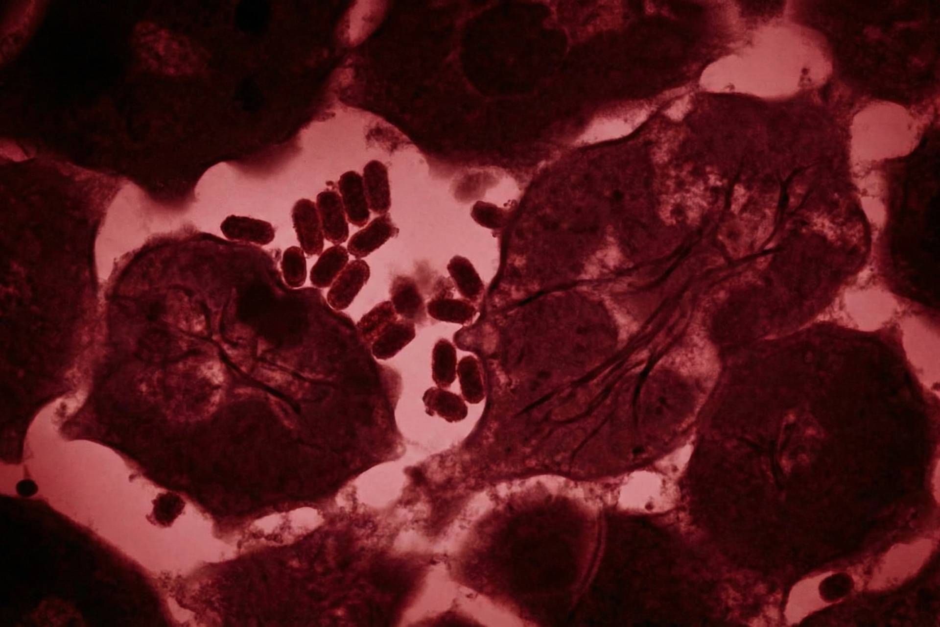 تصویرسازی نمای نزدیک و میکروسکوپی از تکثیر و آلوده شدن سلول‌ها در بافت کلیه انسان توسط ویروس هاری، به رنگ‌های تیره و قرمز.