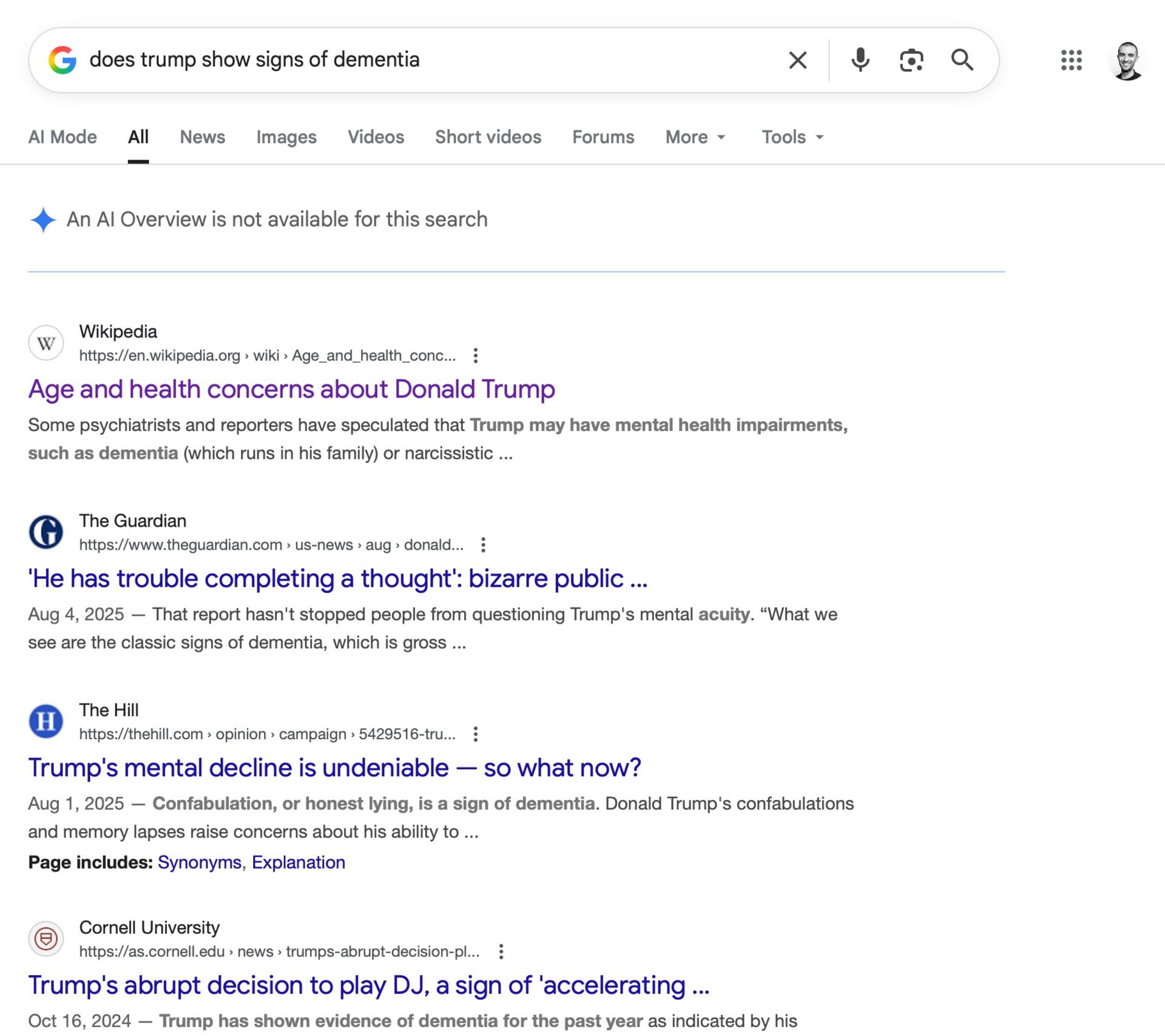 حالت AI Overview در پرسش مربوط به زوال عقل ترامپ