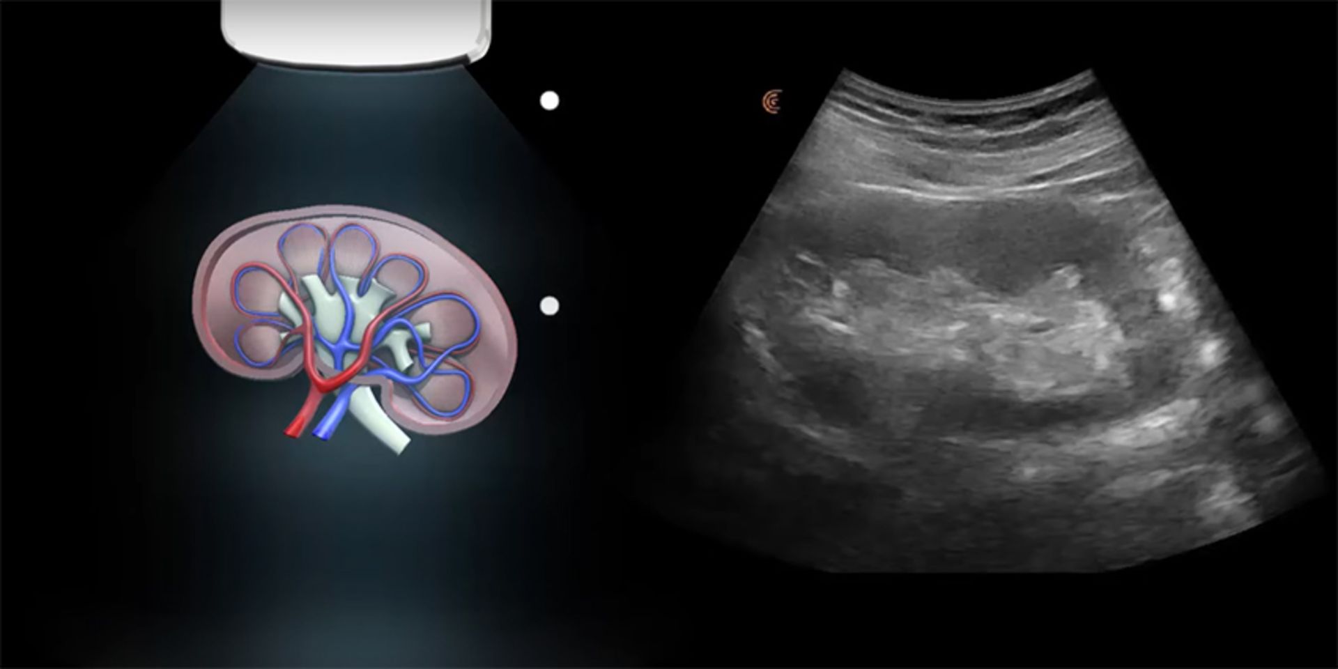 Ultrasound image of kidney