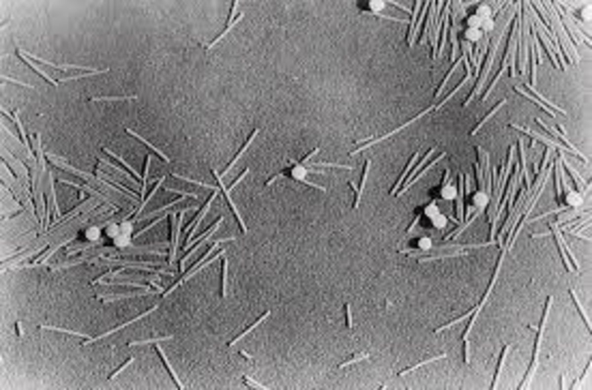 عکسی از اولین ویروسی که کشف شد