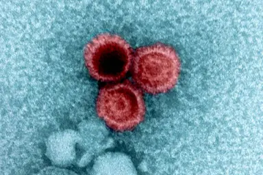 تصویر میکروسکوپی از ویروسها