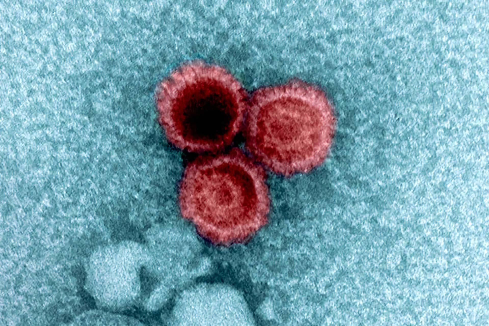 تصویر میکروسکوپی از ویروسها