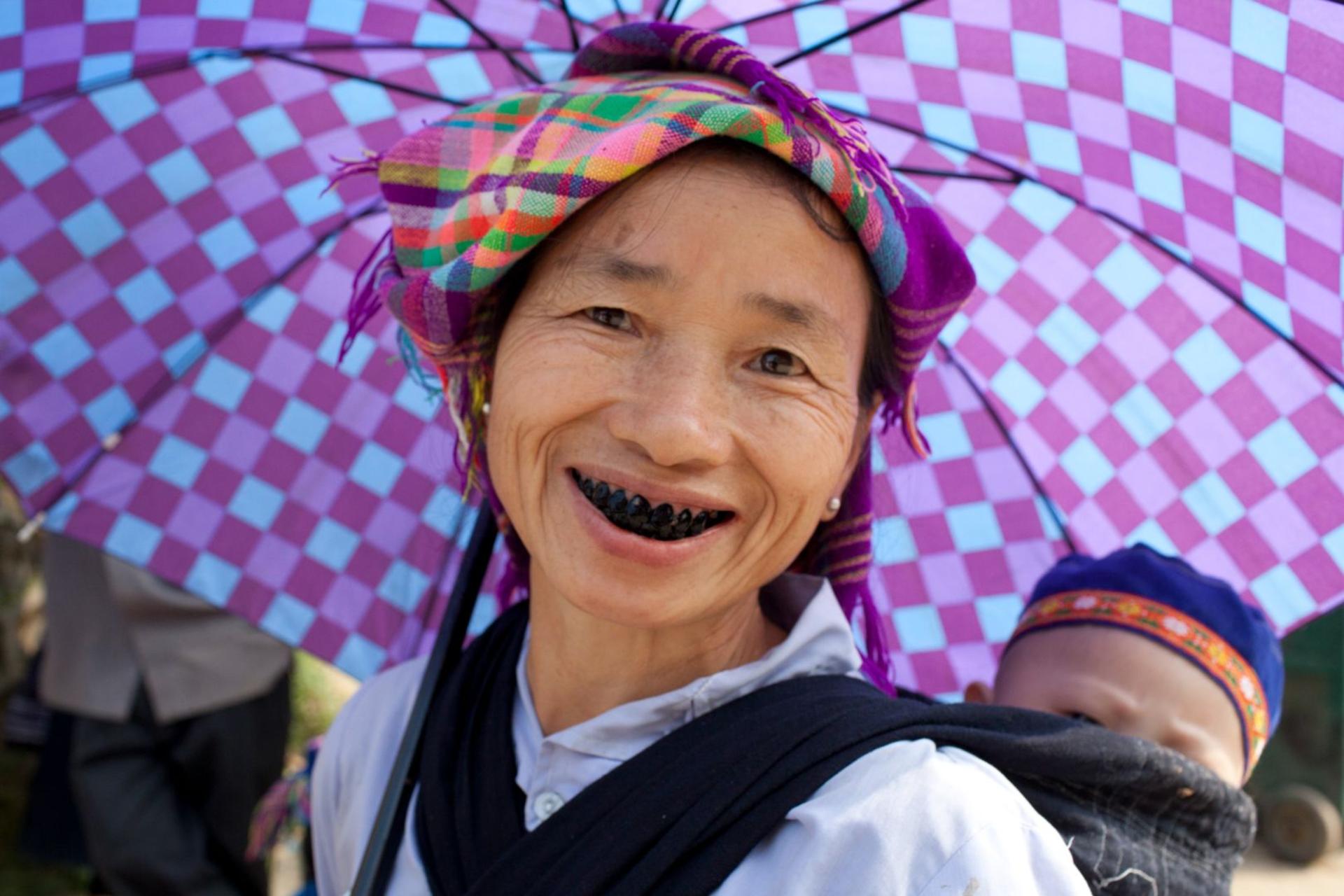 زنی با دندان سیاه در ویتنام نوه‌ی خود را در آغوش گرفته و با خود حمل می‌کند.