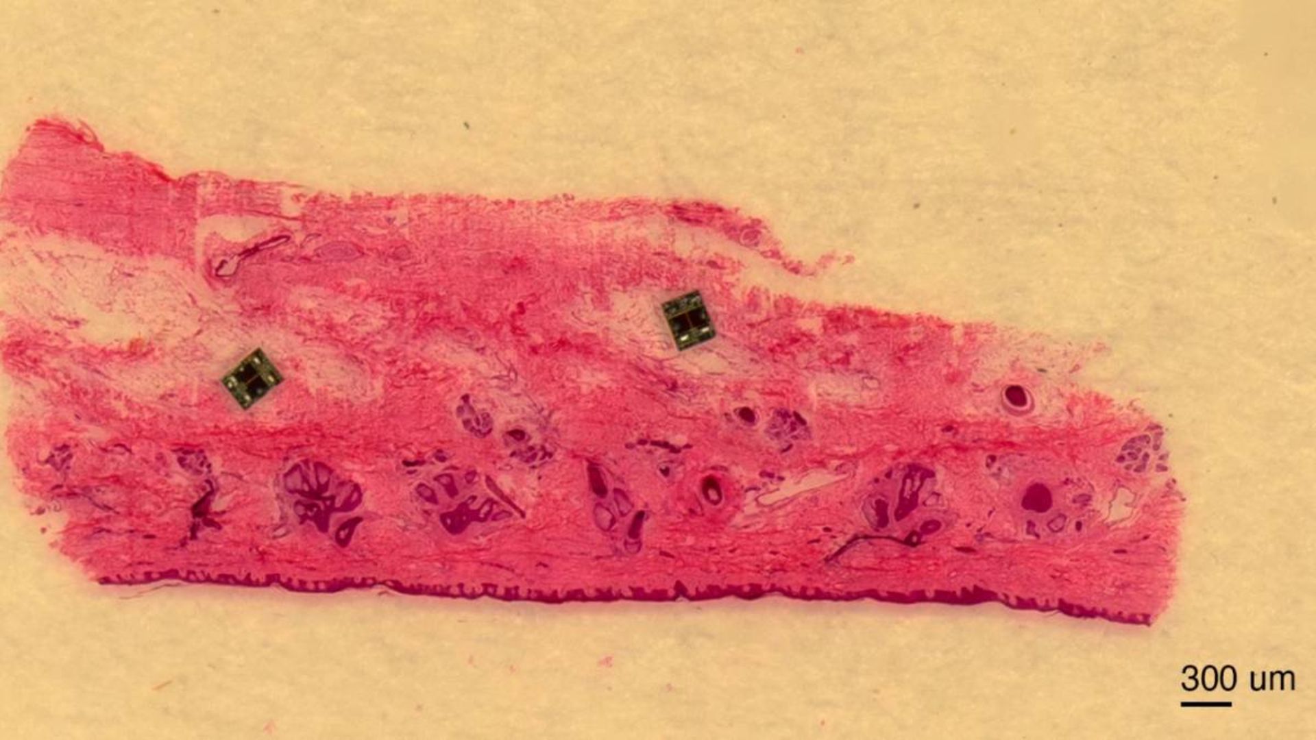 میکروربات مجهز به حسگر روی بافت پوست