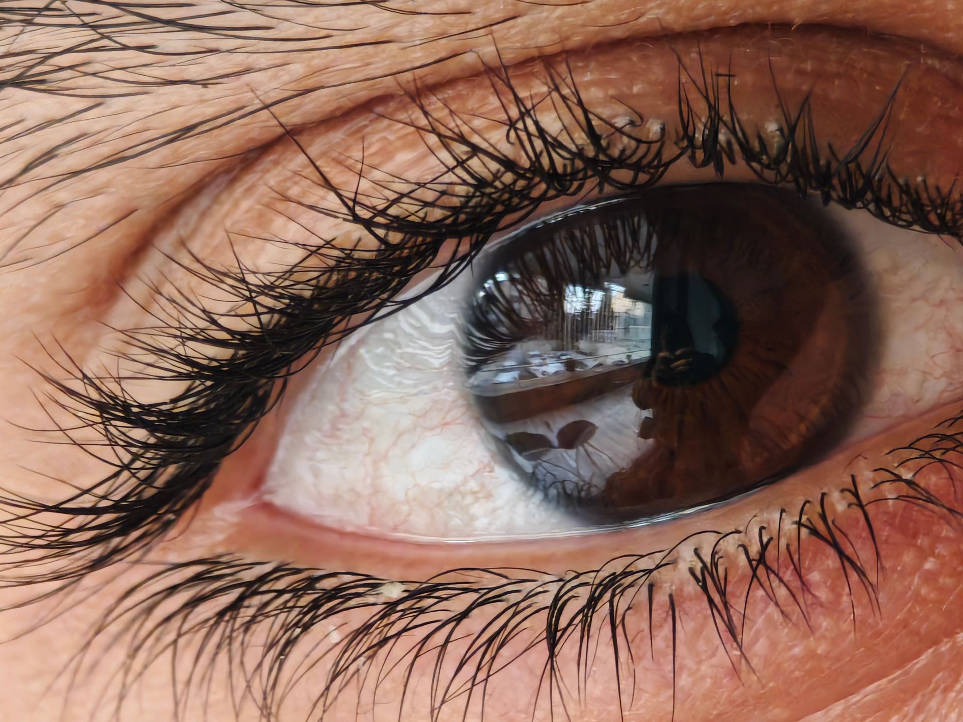 چشم از نمای نزدیک