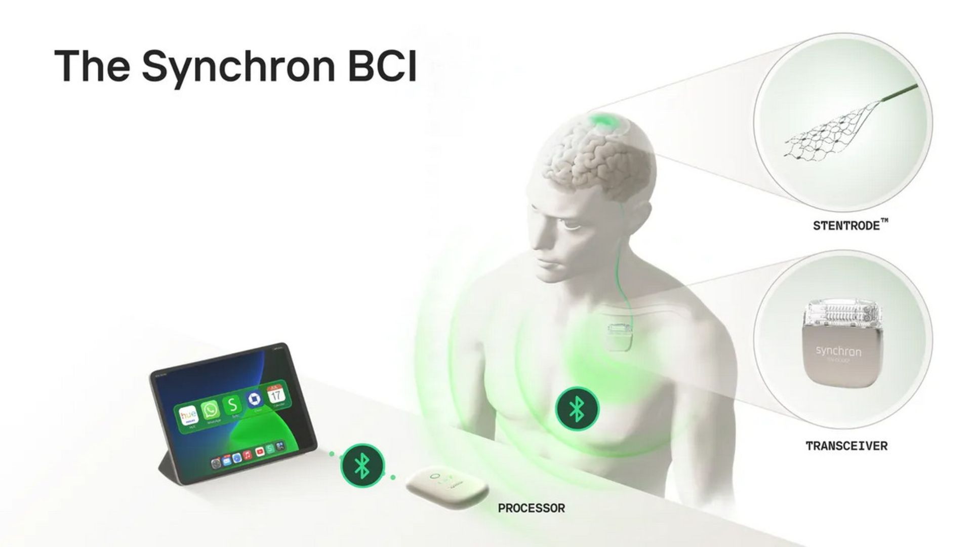 نسل بعدی رابط مغز و کامپیوتر (BCI) شرکت سینکرون 